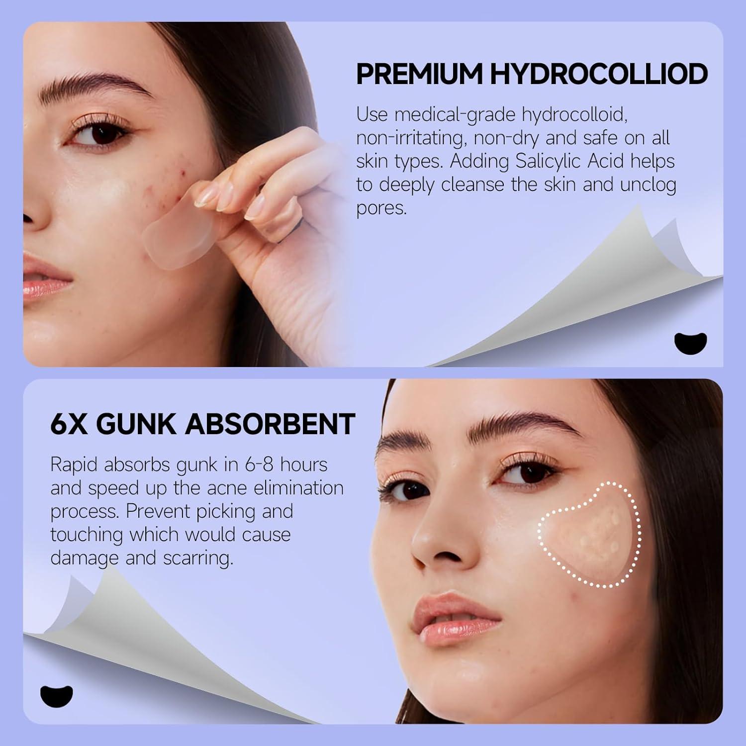 Parche para Acné Dazzlook - Hidrocoloides Extra Grandes 12 Unidades