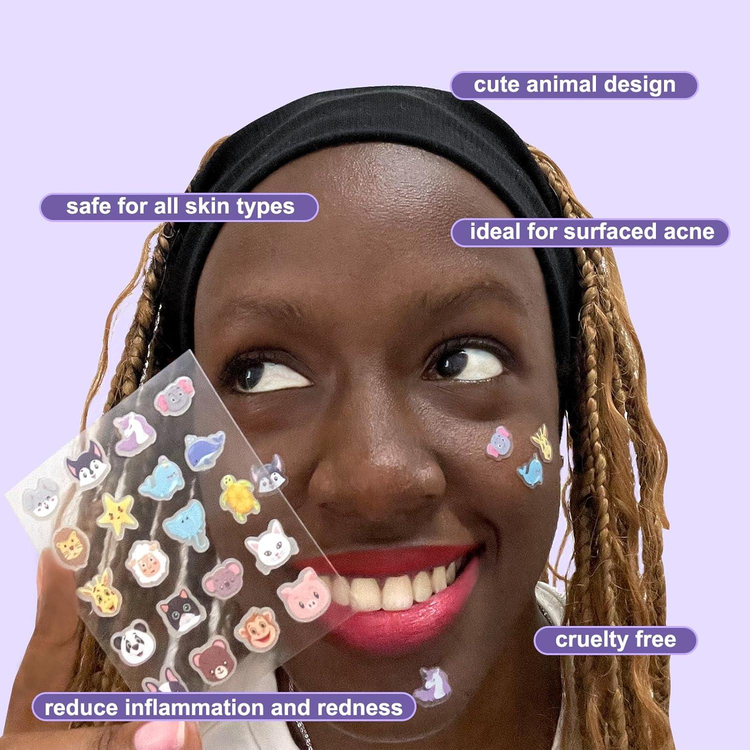 Parche Hidrocoloide para Acné Yorkline - 120 Unidades con Ácido Salicílico