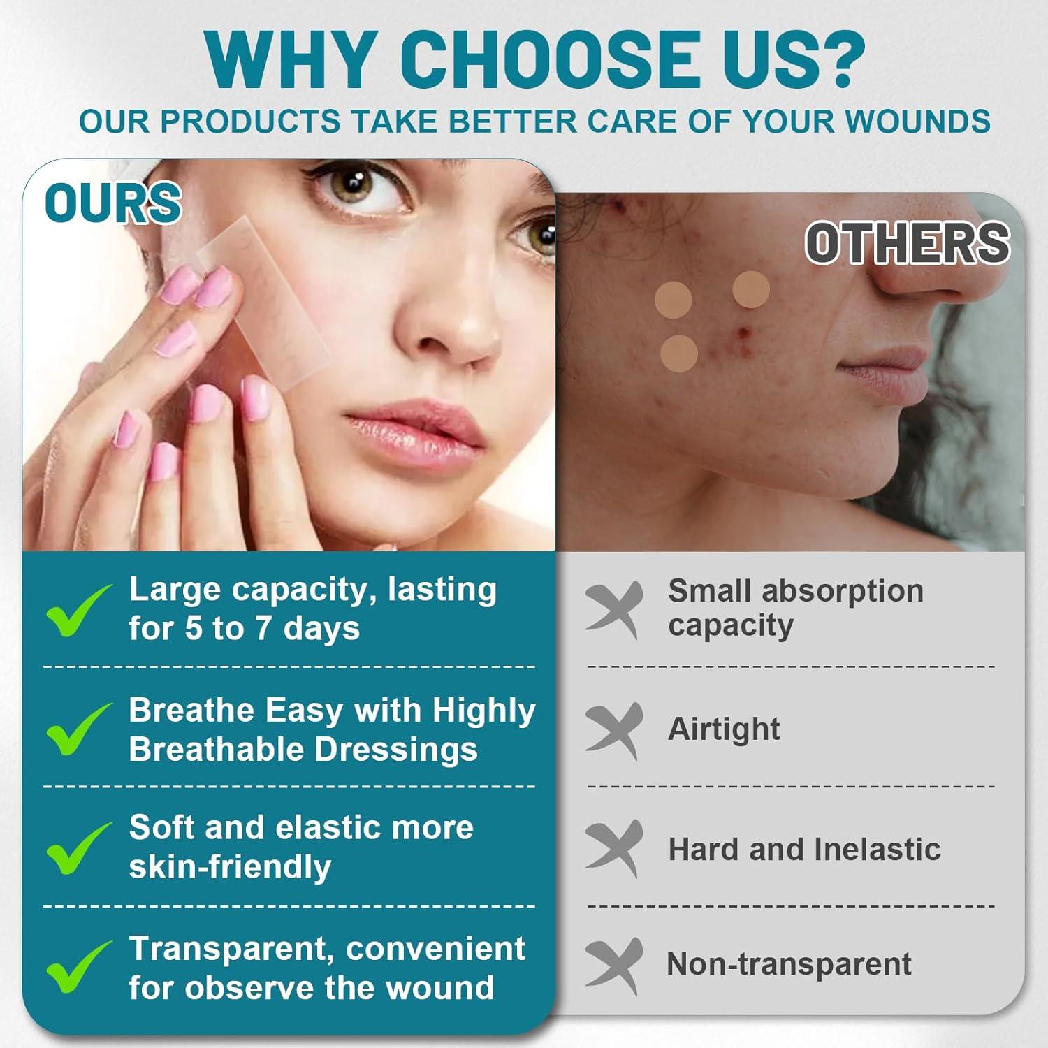 Rollo de Hidrocoloide WUYUAN 5cm x 5m Vendajes Impermeables