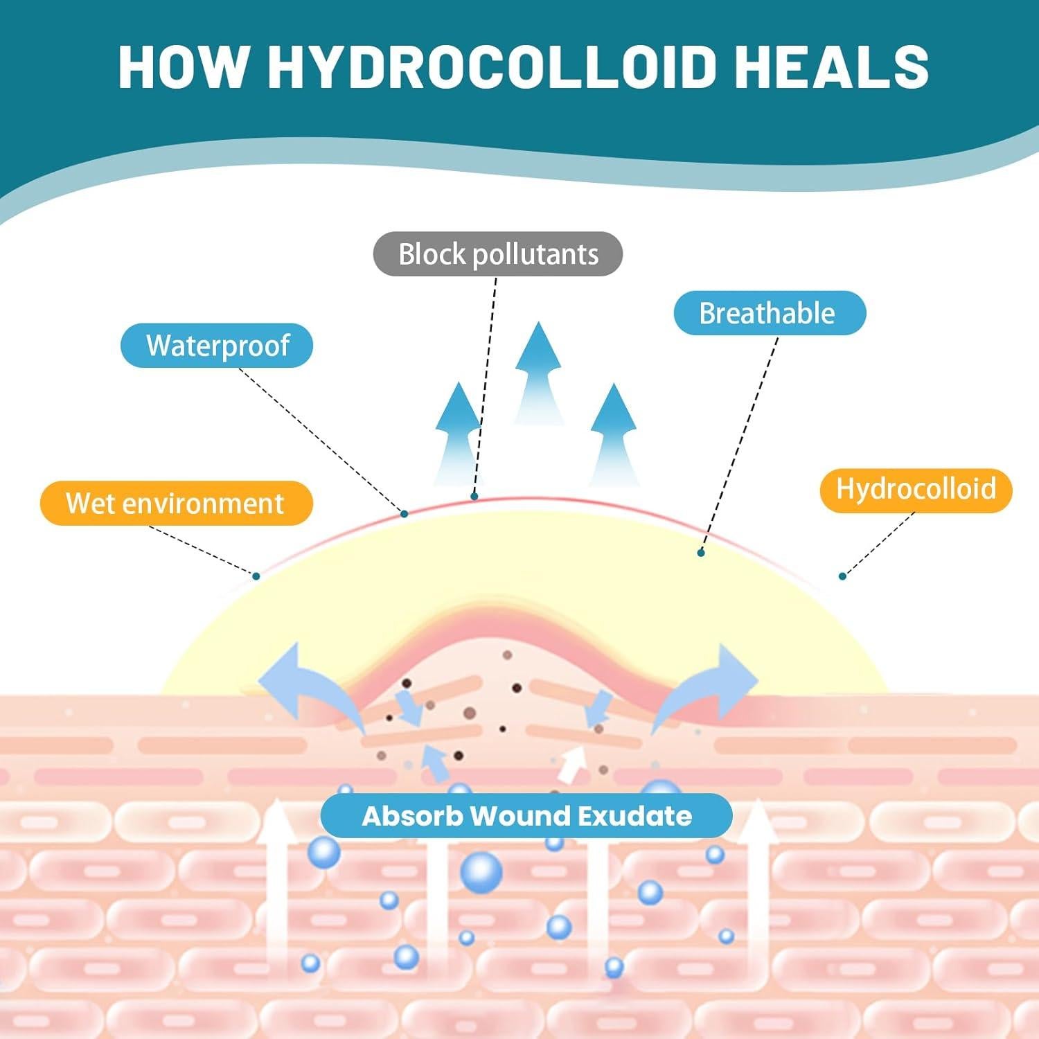 Rollo de Hidrocoloide WUYUAN 5cm x 5m Vendajes Impermeables