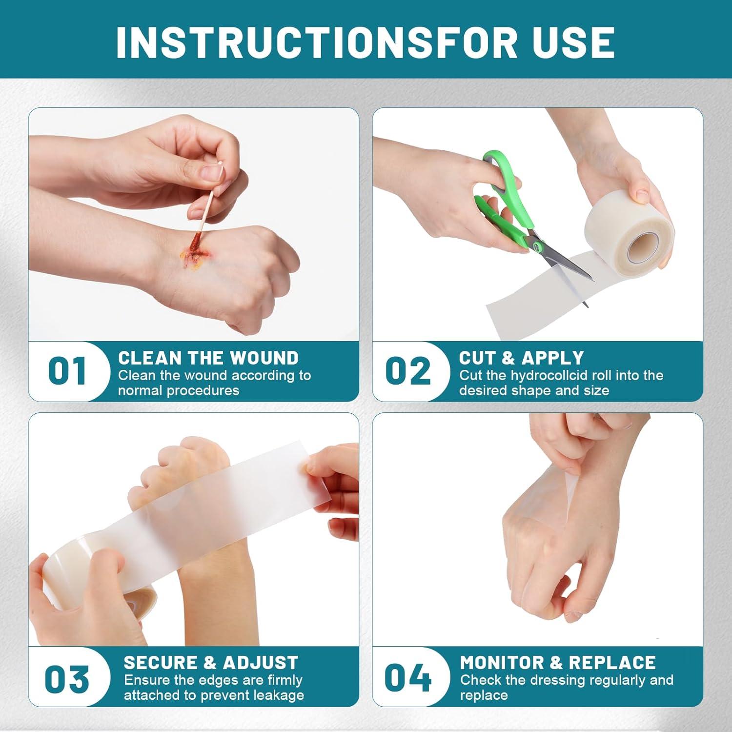 Rollo de Hidrocoloide WUYUAN 5cm x 5m Vendajes Impermeables