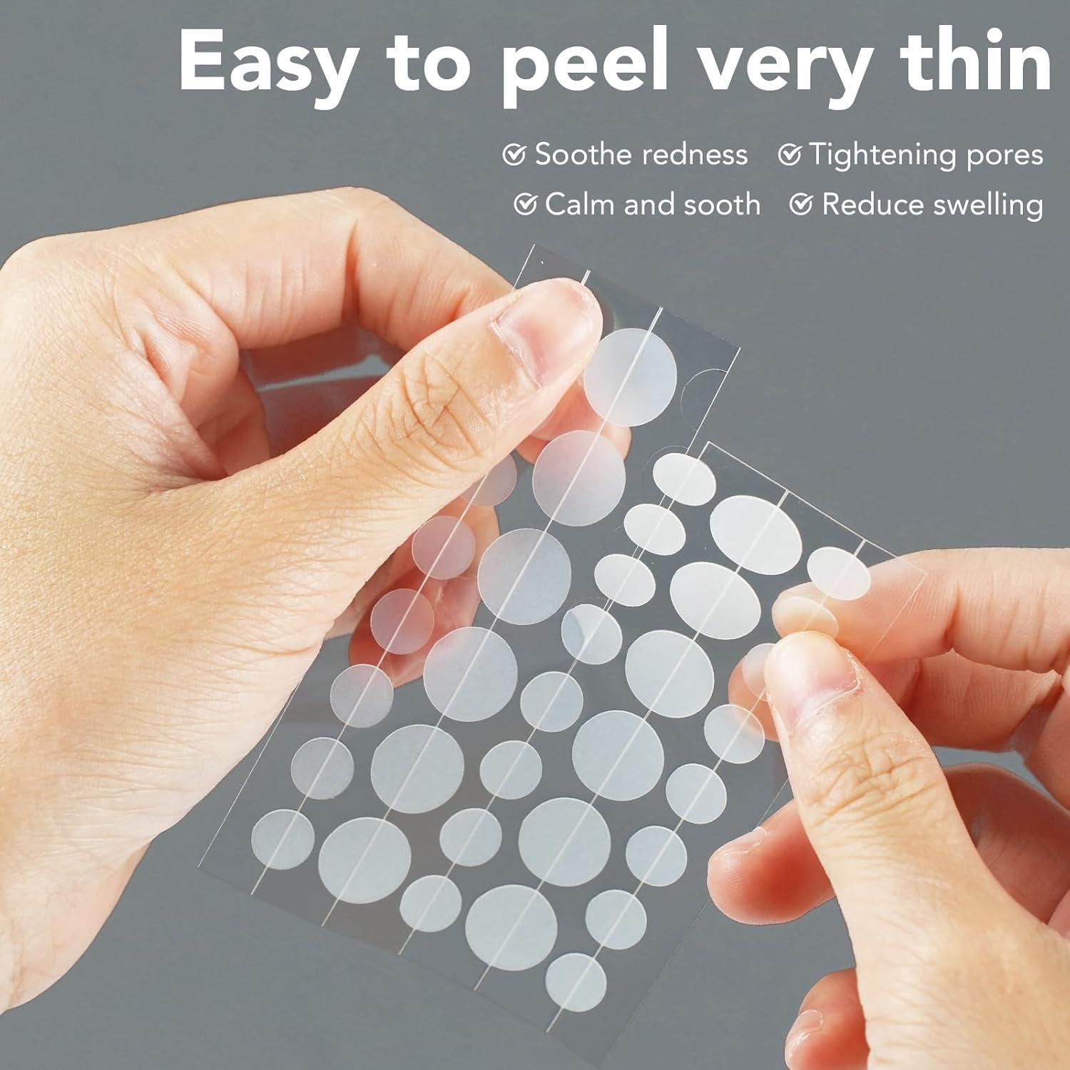 Parches para Granos Qmakup - 360 Unidades Hidrocoloides