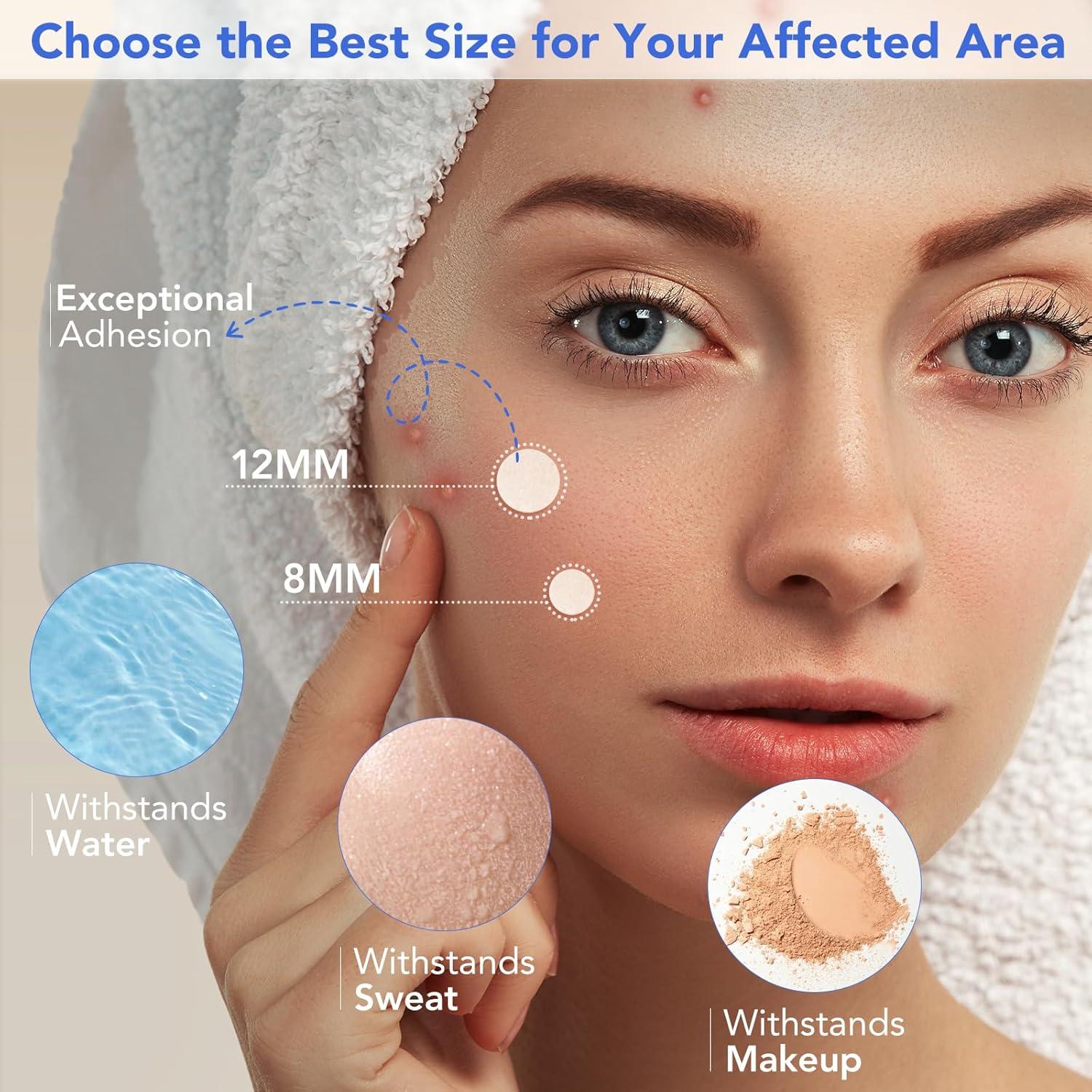 Parches para Granos Qmakup - 360 Unidades Hidrocoloides