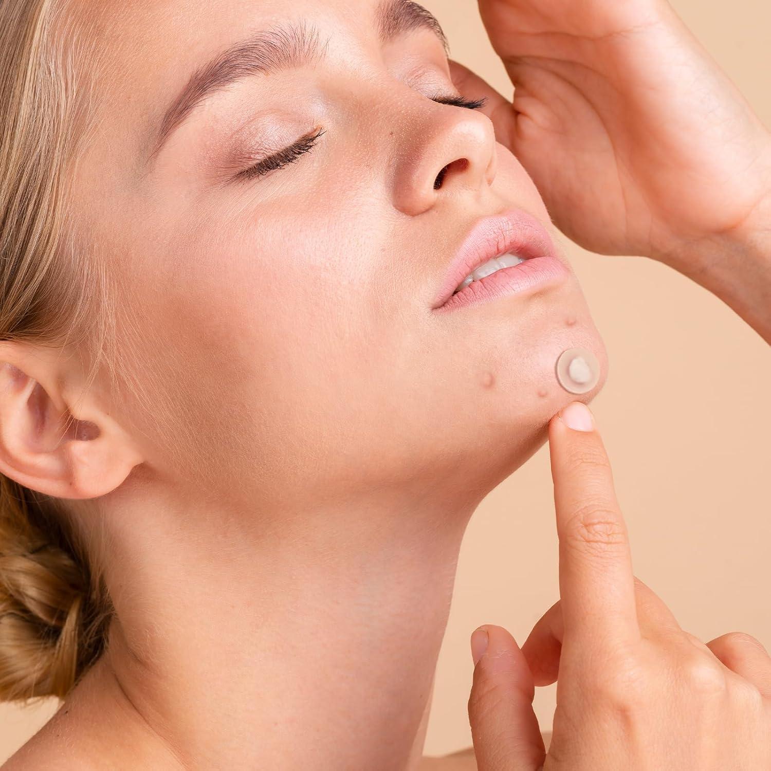 Parches para Granos Qmakup - 360 Unidades Hidrocoloides