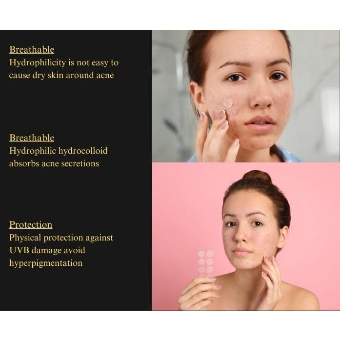 Parche Hidrocoloide para Granitos ZK - 36 Unidades, Ácido Salicílico