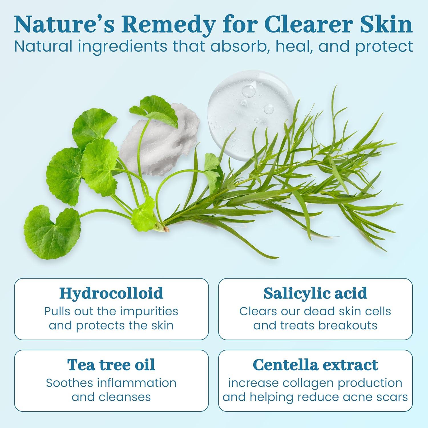 Parche Hidrocoloide para Acné Clean Slate Squad - 4 Tamaños