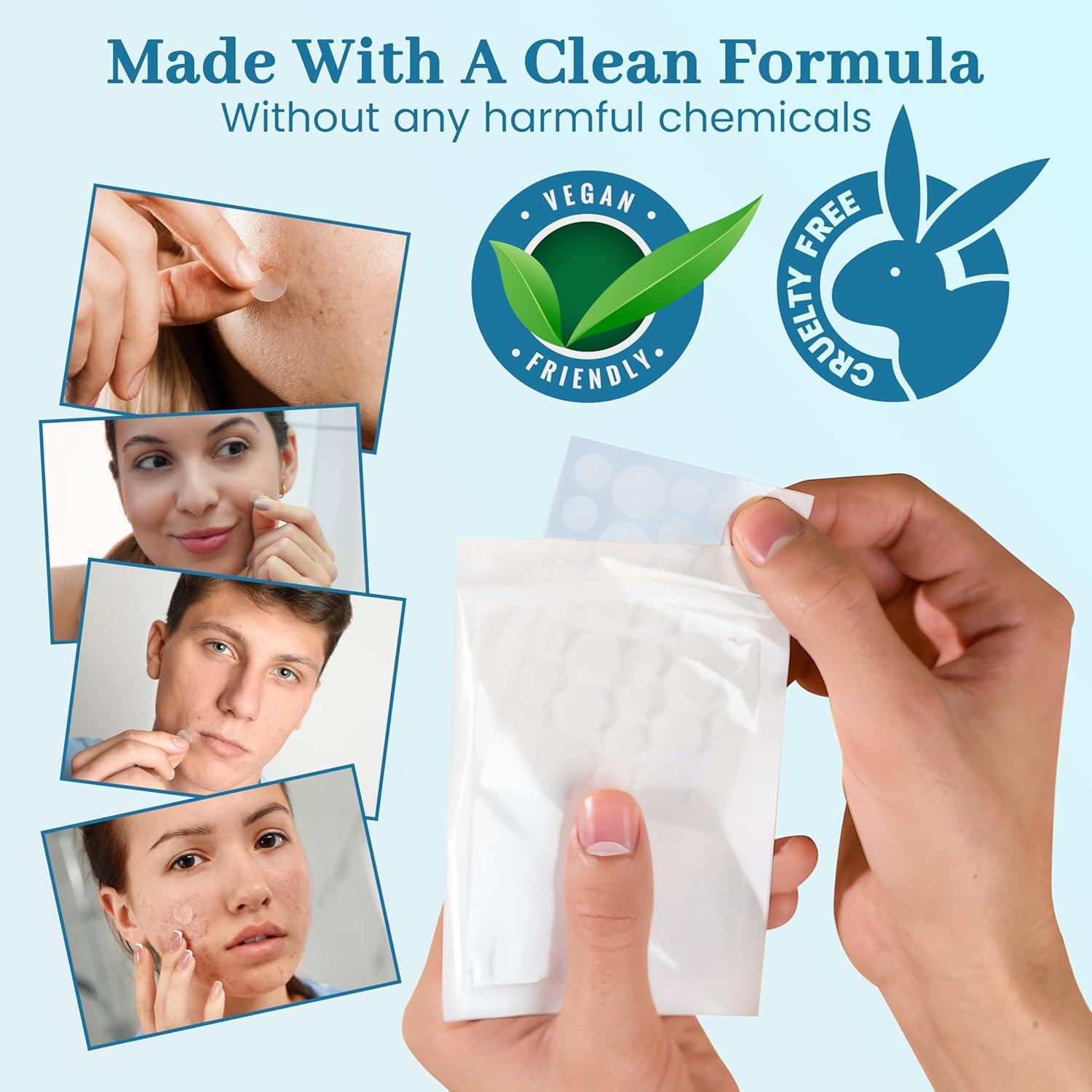 Parche Hidrocoloide para Acné Clean Slate Squad - 4 Tamaños