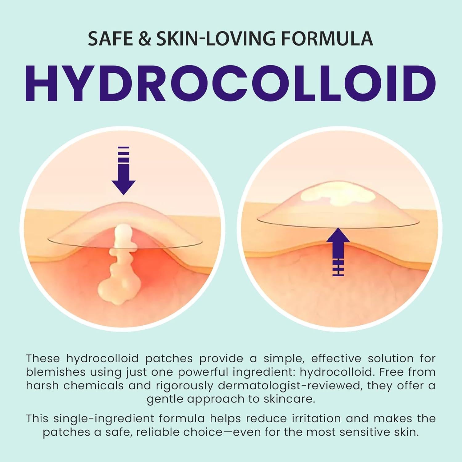 Parche Hidrocólico Invisible 36 Unidades 12mm 4ever Beauty