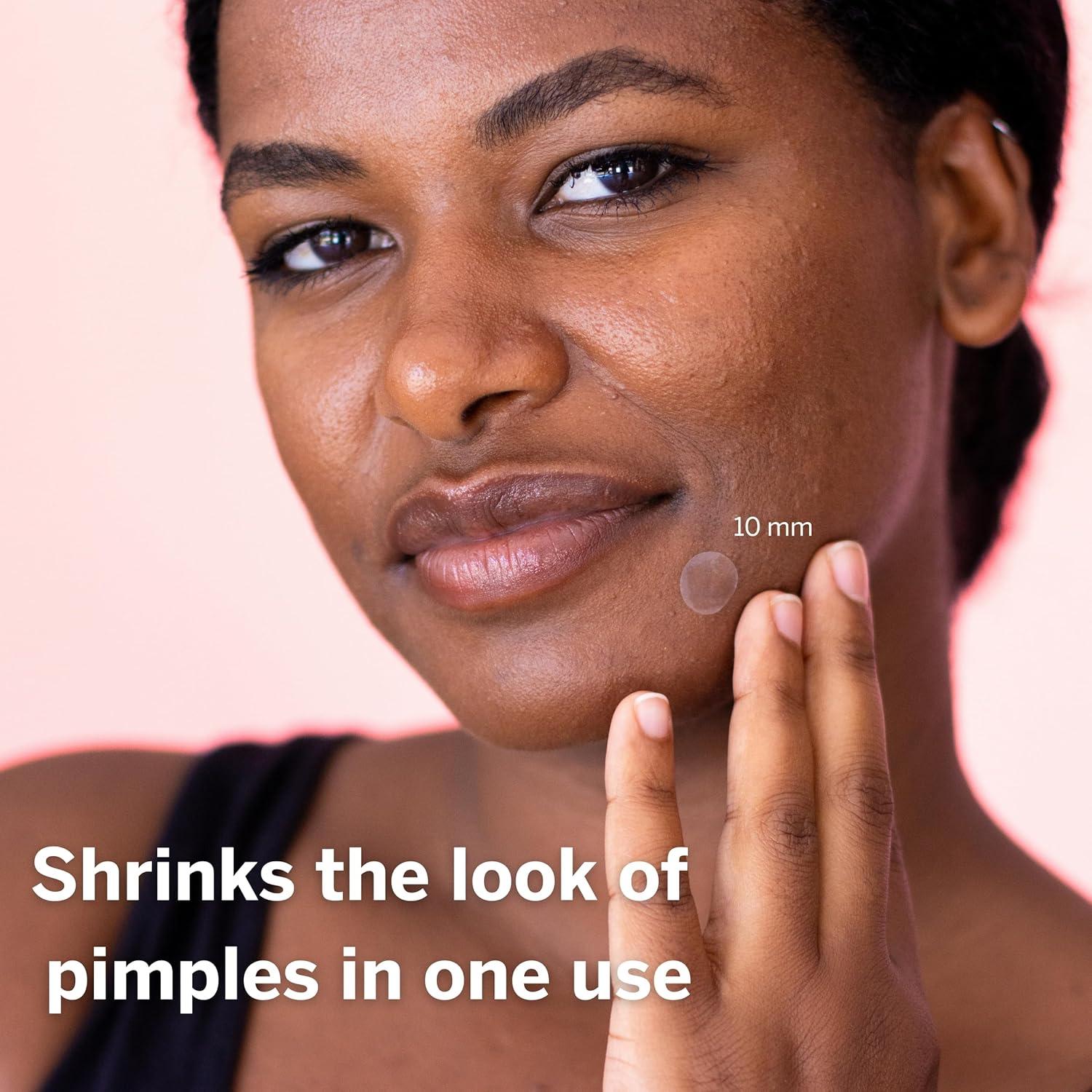 Parche Hidrocoloide para Granos Dot - 120 Piezas 10 mm