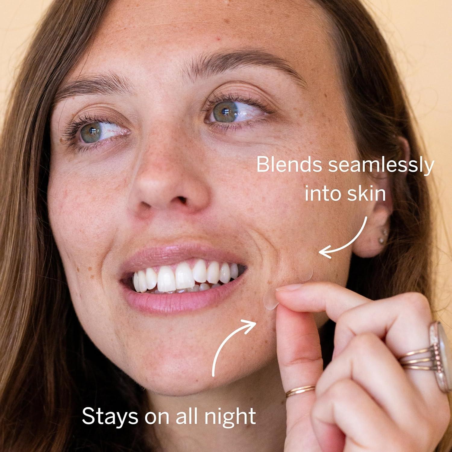 Parche Hidrocoloide para Granos Dot - 120 Piezas 10 mm