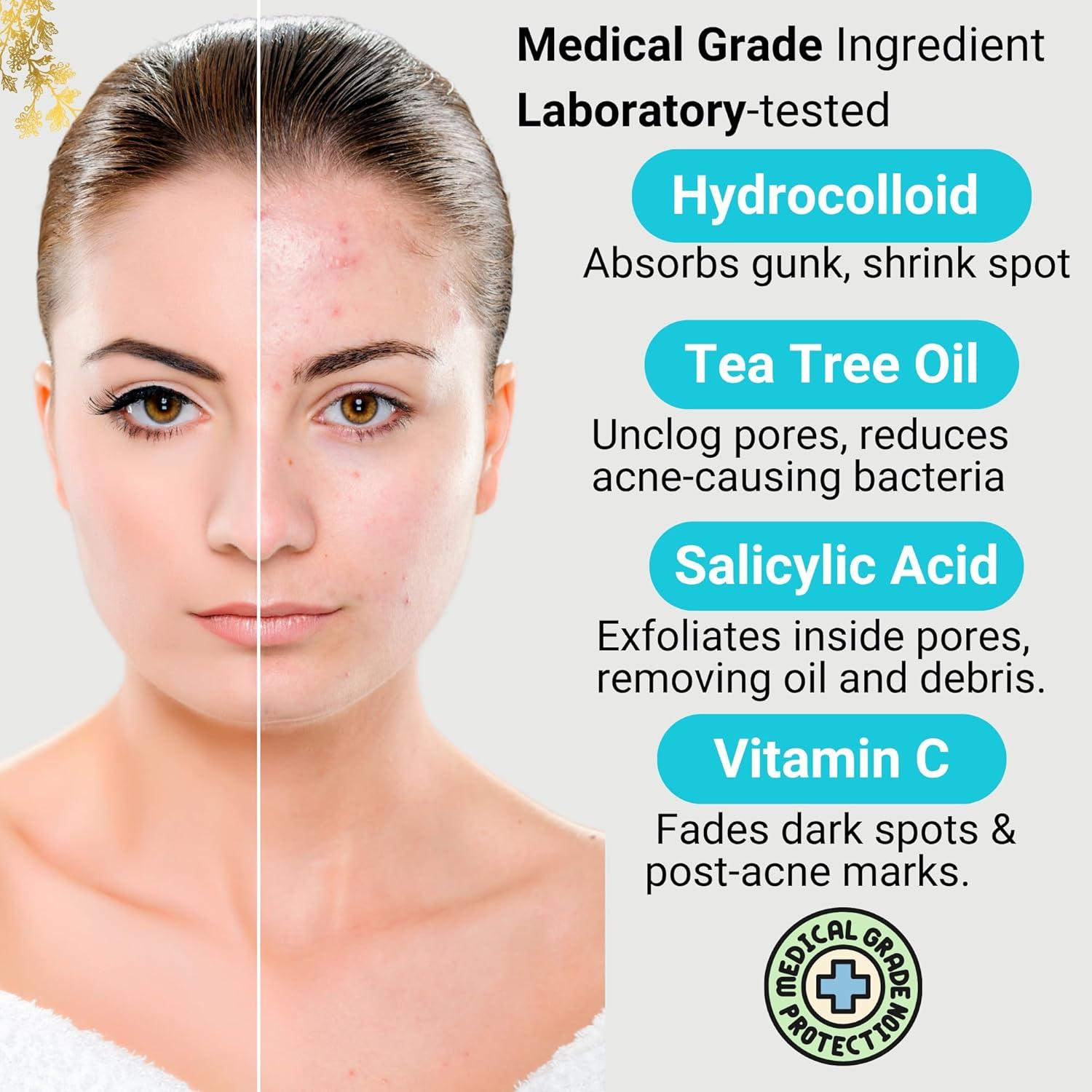 Parche Hidrocoloide SpotlessX para Acné - 96 Parches, 3 Tamaños