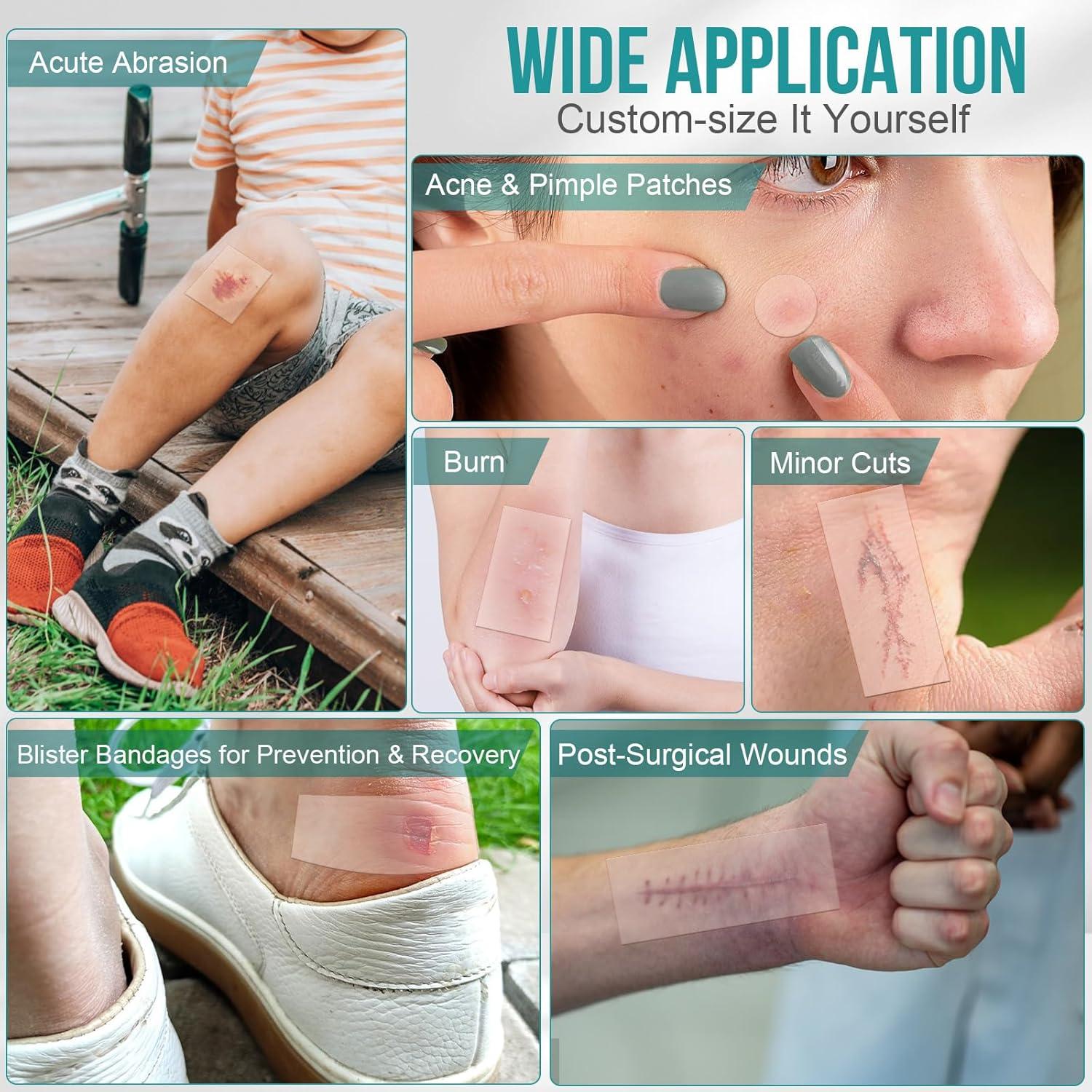 Rollos de hidrocoloide YHOVID 7.62cm x 2.44m para heridas