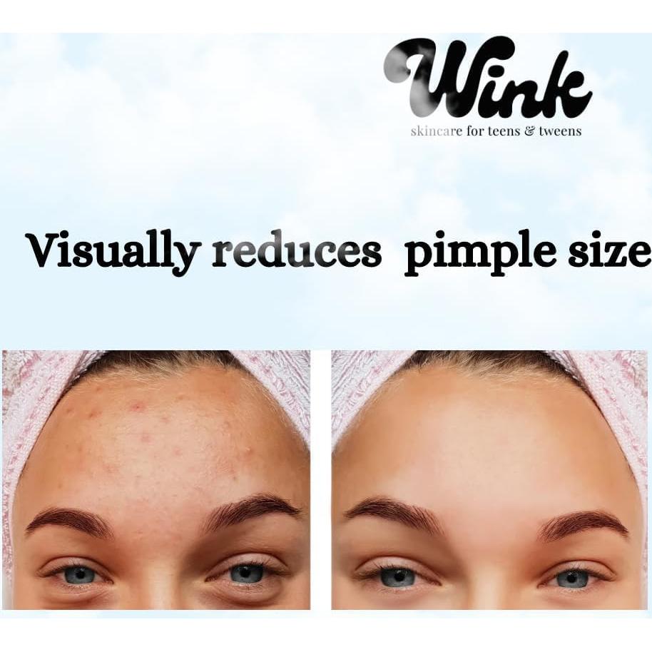 Parche Hidrocoloide para Espinillas Wink Skincare - 120 Unidades