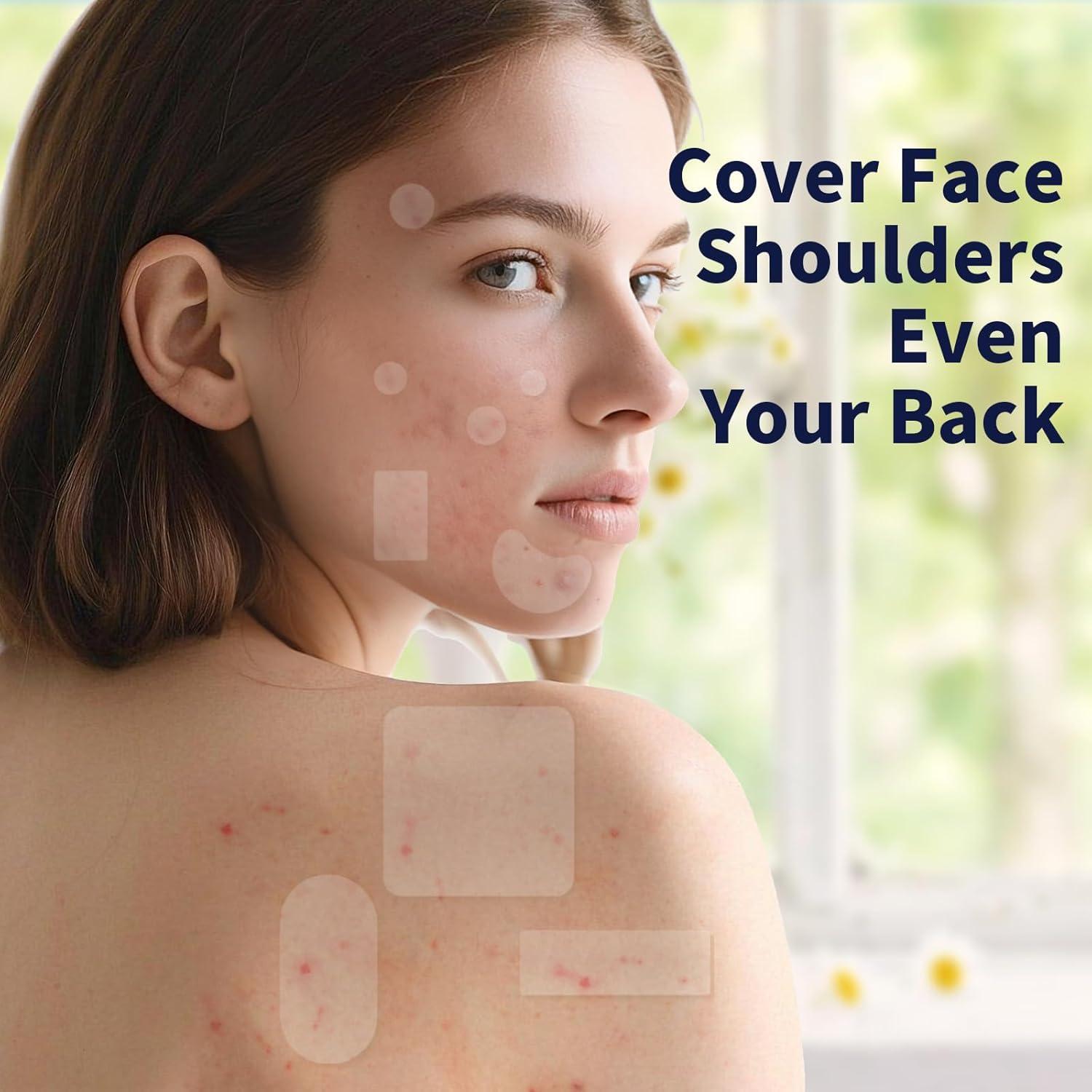 Parches para Espinillas Zeefpod XL - 264 Unidades, 9 Tamaños