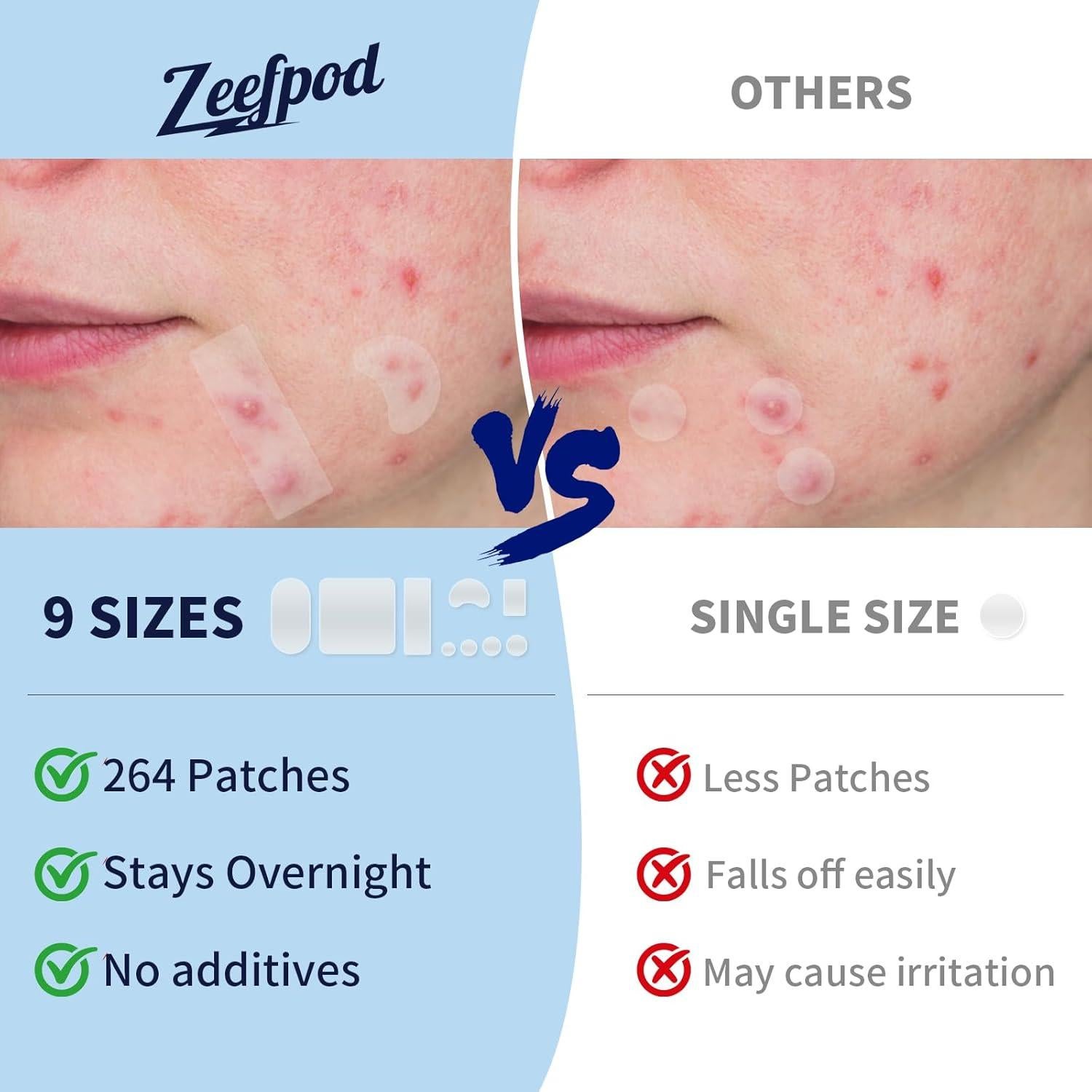 Parches para Espinillas Zeefpod XL - 264 Unidades, 9 Tamaños