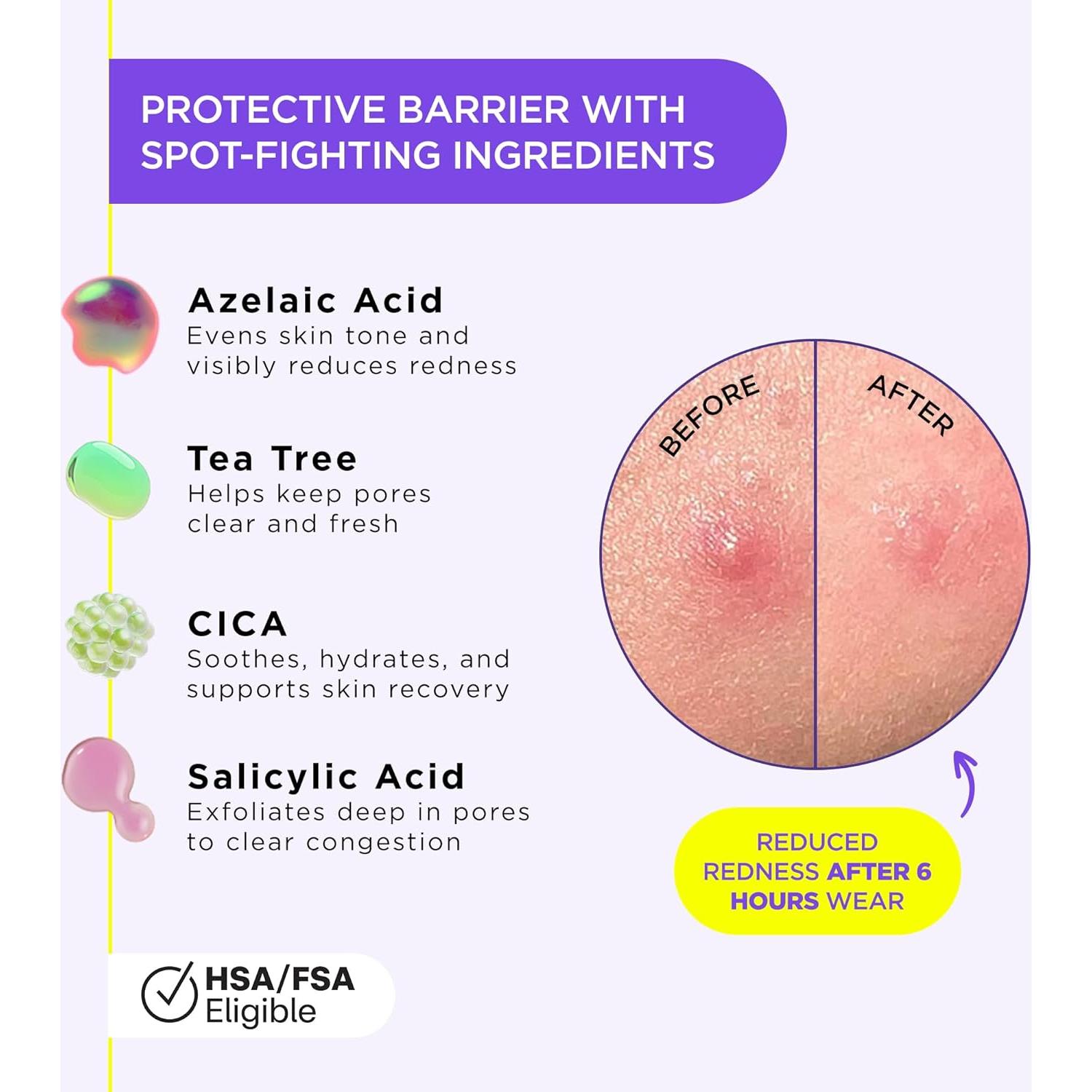 Parche Líquido para Espinillas ZitSticka 10ml - Invisible y Efectivo