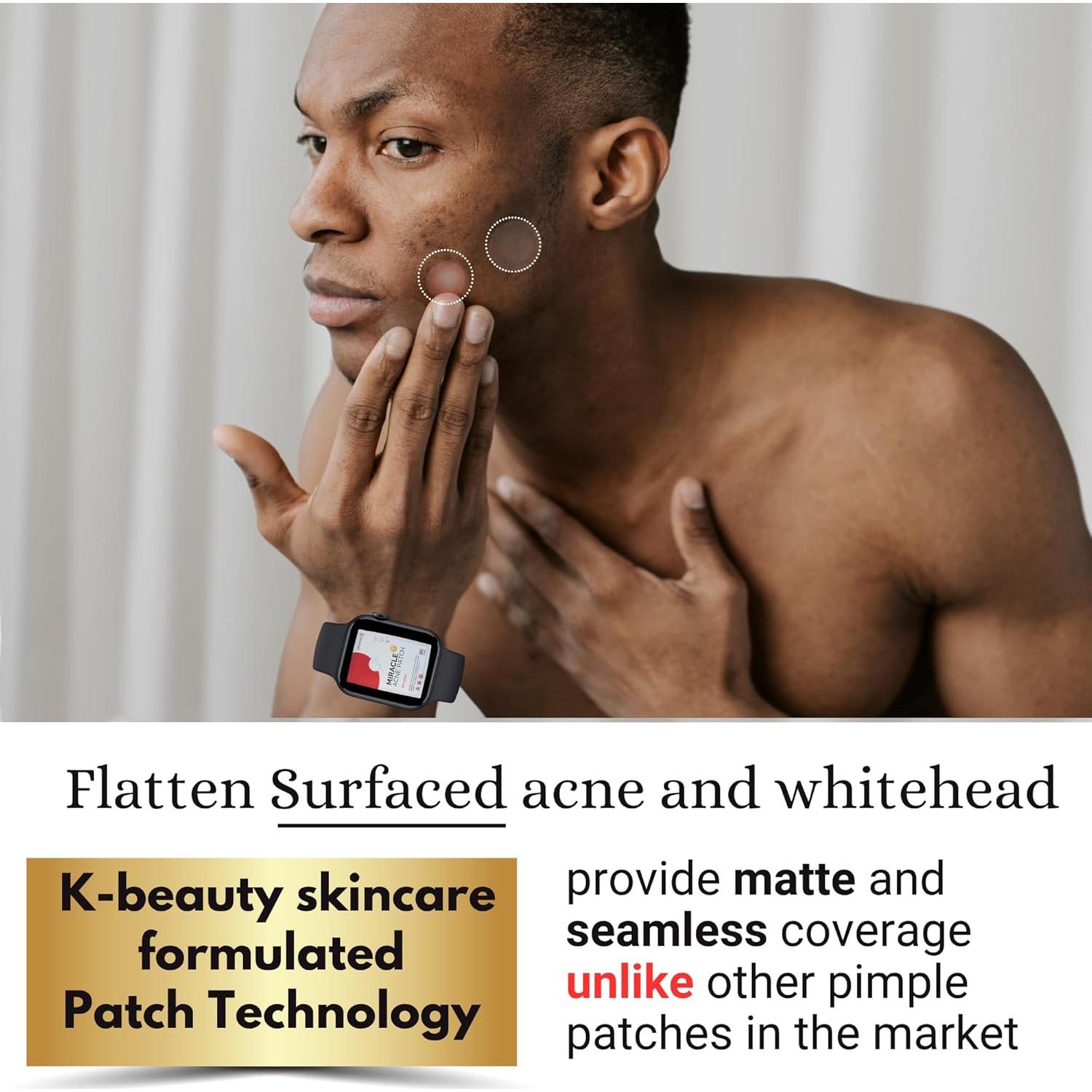 Parche Milagroso Hidrocoloide para Granitos - 96 Unidades