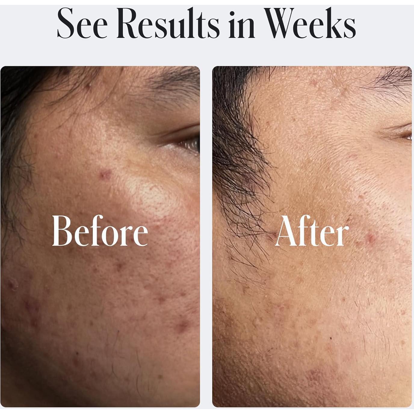 Crema Hidratante Reparadora Geologie 60ml con Retinol y Niacinamida