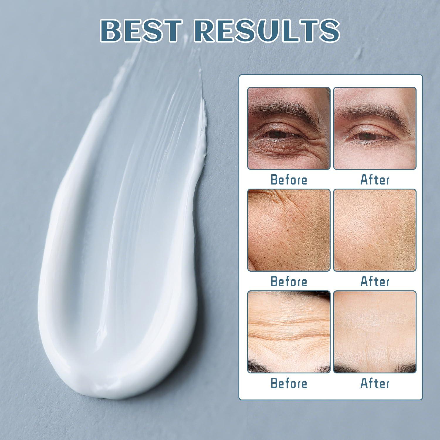 Crema Facial 6-en-1 YOUNGYOUNGLOVE para Hombres 48 g