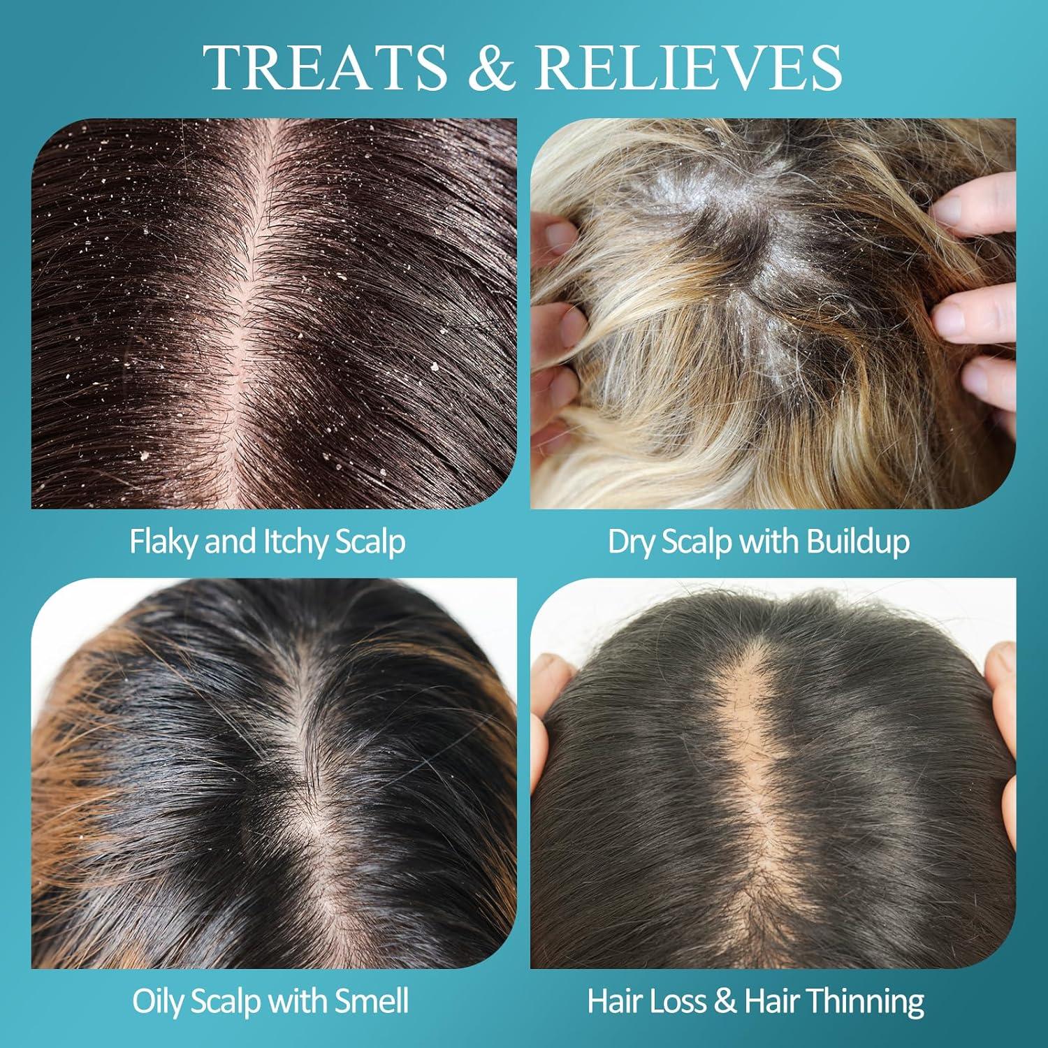 Exfoliante para Cuero Cabelludo Biotina 250g con Ácido Salicílico