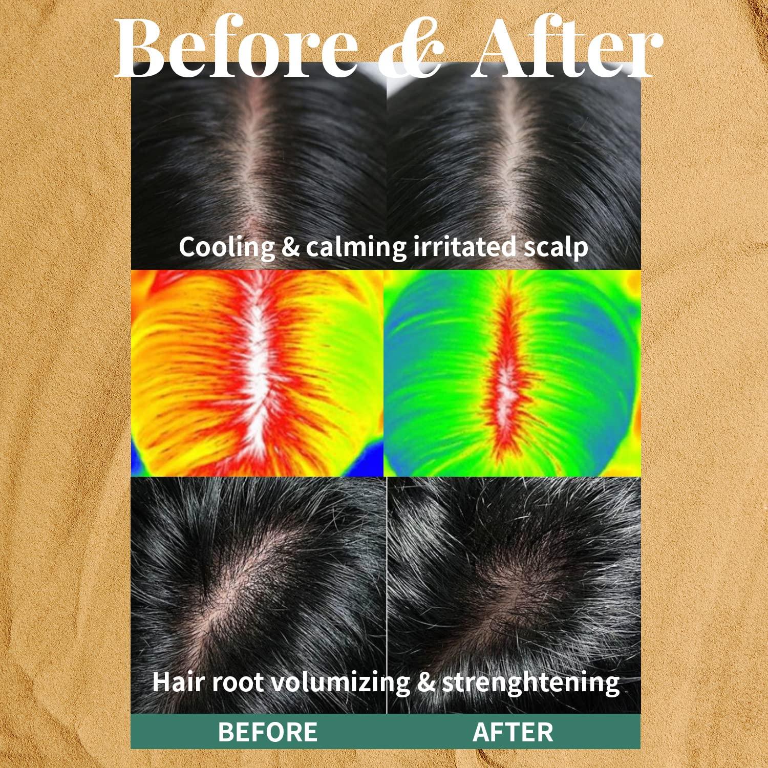 Exfoliante para Cuero Cabelludo PLU con Masajear de Silicona