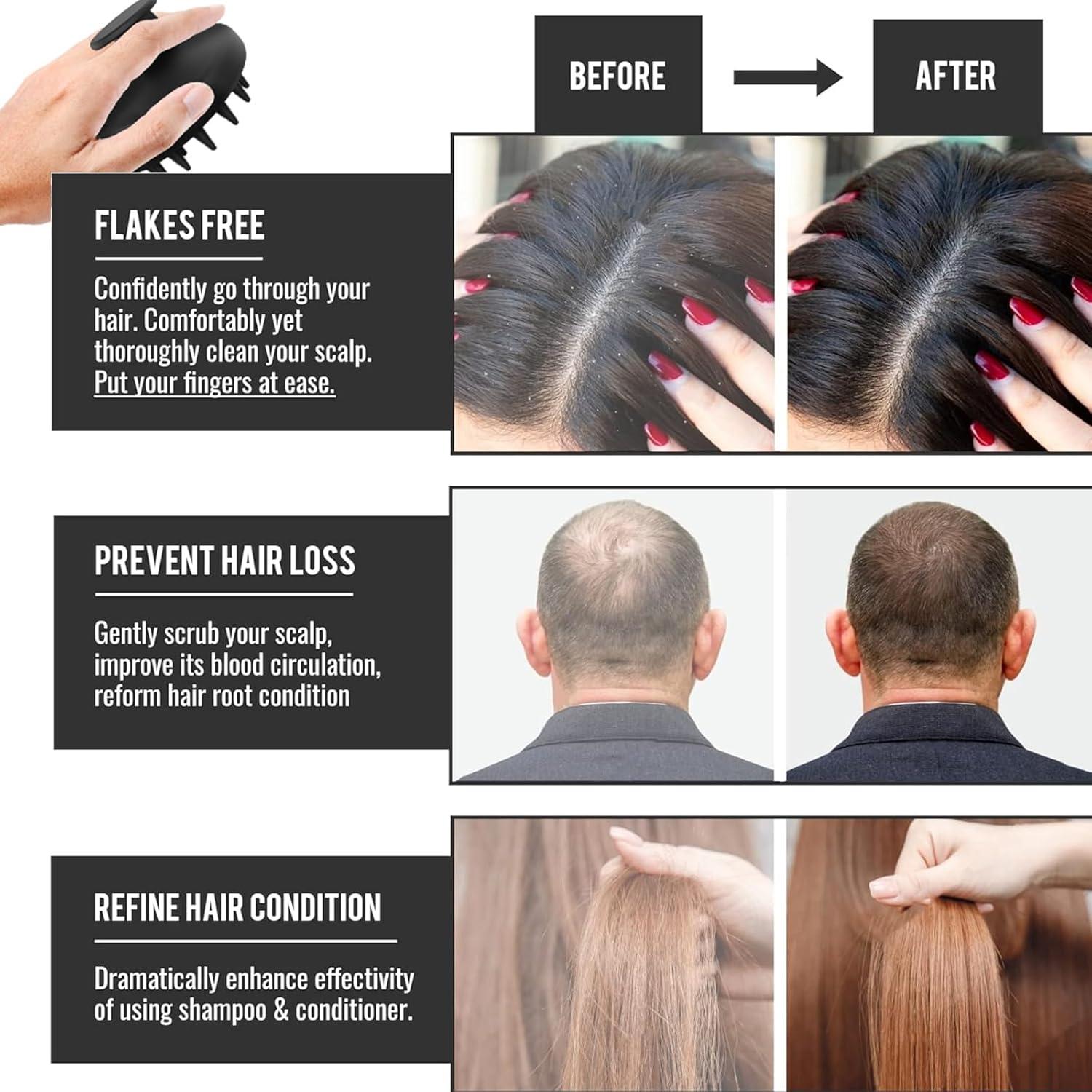 Cepillo de Silicona MZEL para Masaje del Cuero Cabelludo 7.5cm