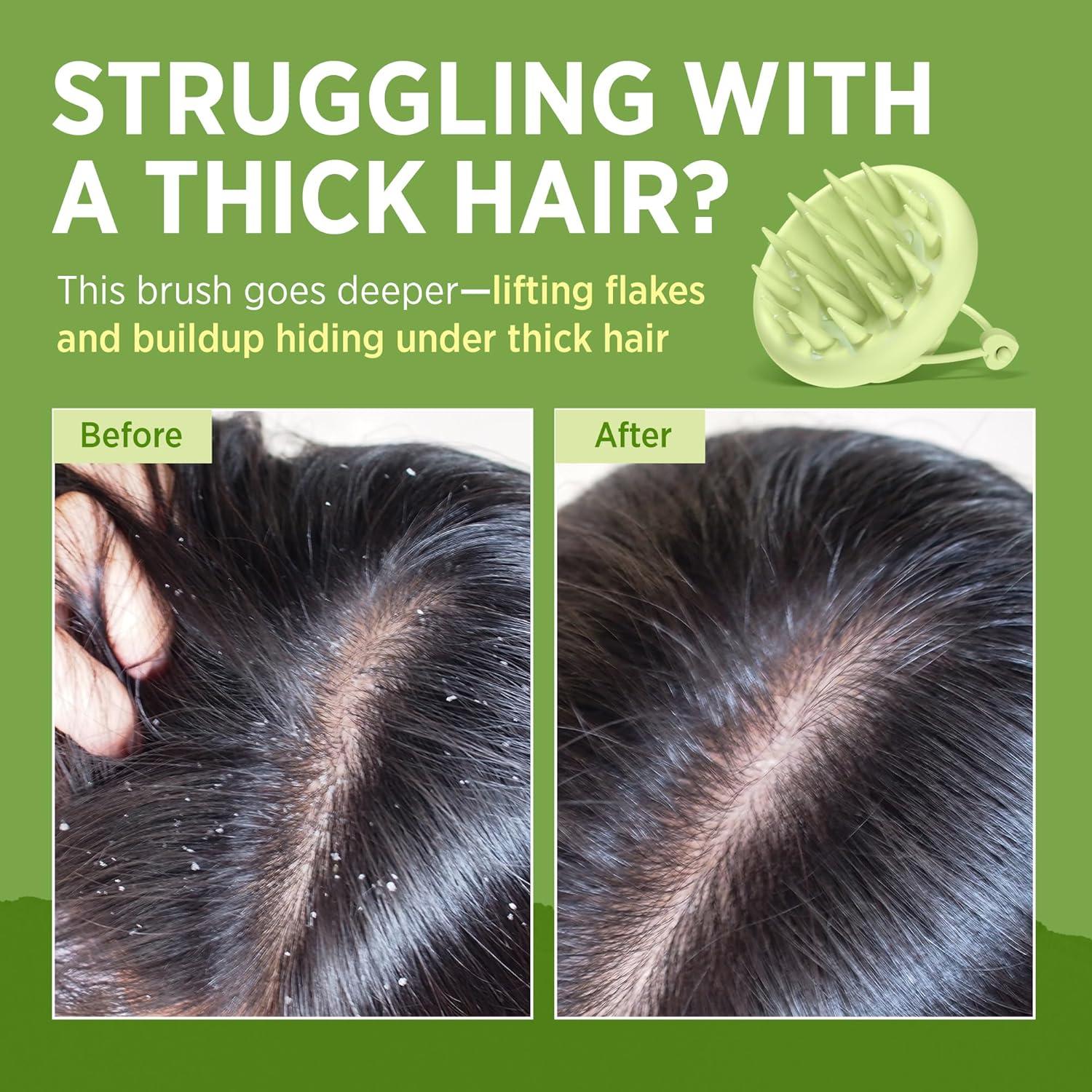 Cepillo Masajeador de Cuero Cabelludo Roycederm - Silicona Suave