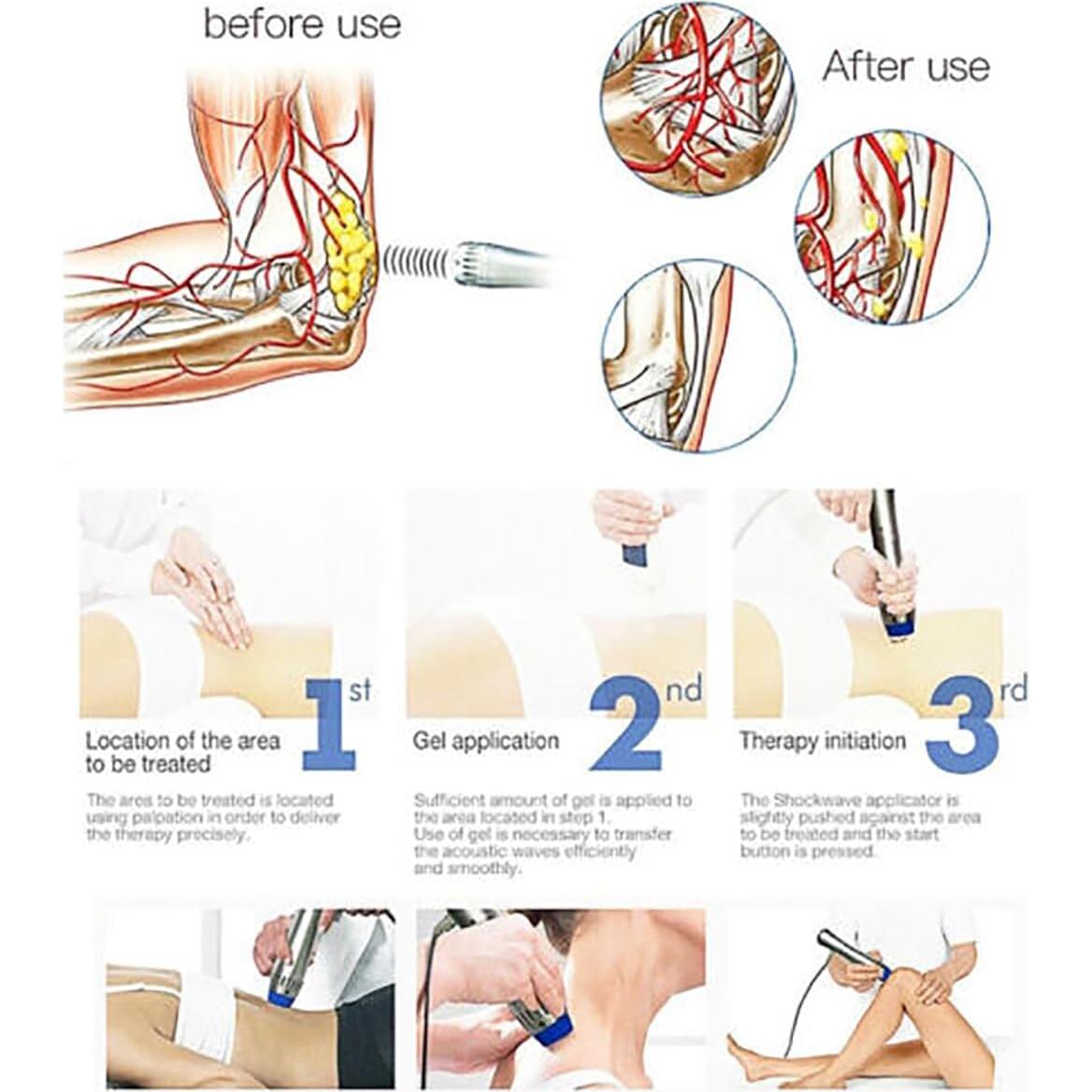 Pistola de Masaje Muscular Shefmon SW15C 7 Cabezas Alivio Dolor
