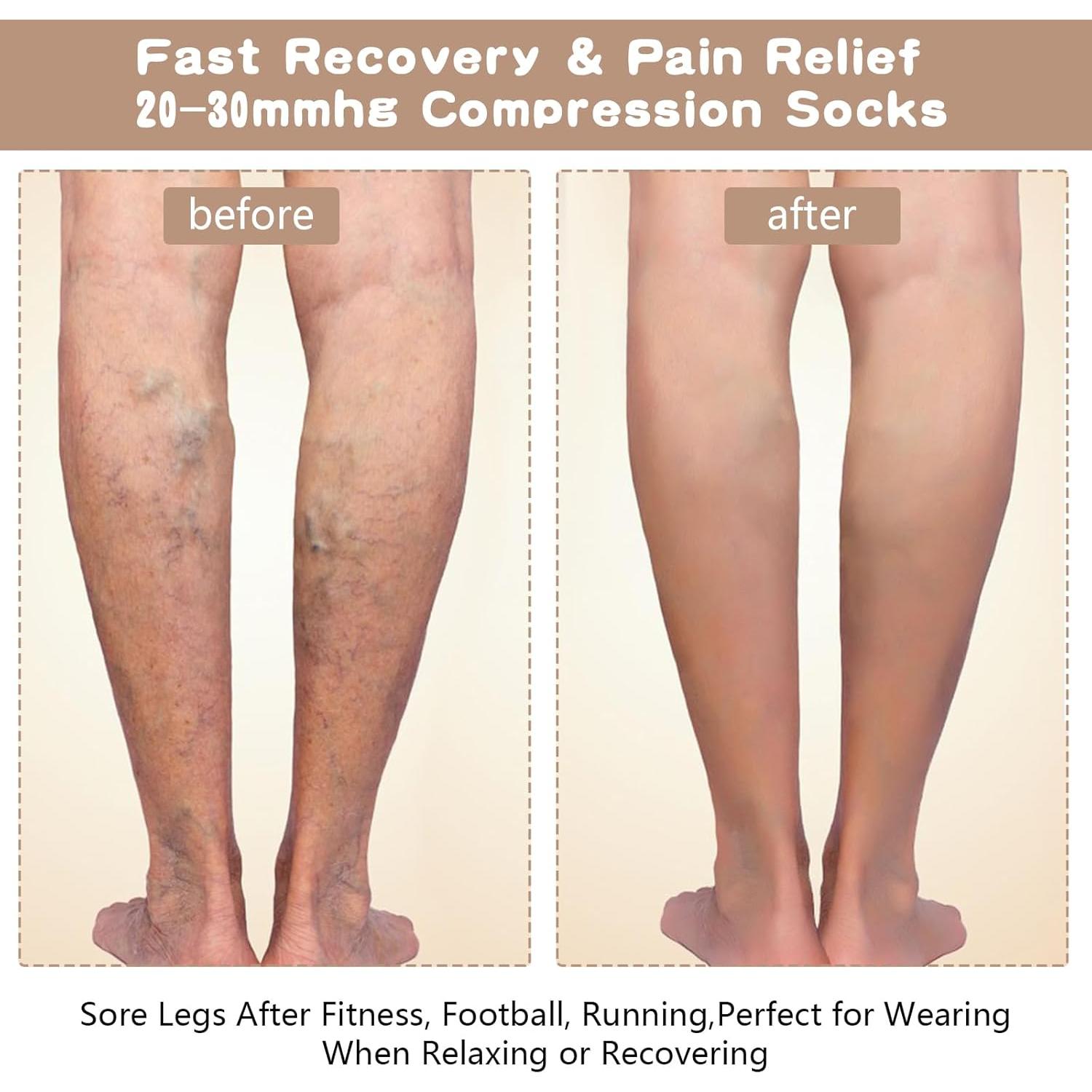 Calcetines de Compresión Dimeho Punta Abierta 15-20 mmHg 2 Pairs