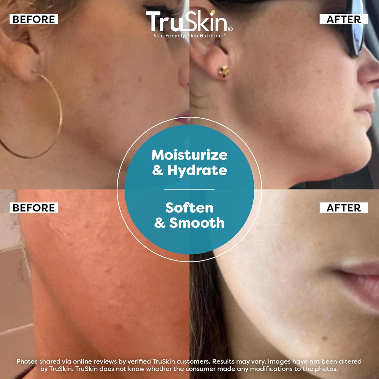 Suero Facial Hidratante TruSkin Ácido Hialurónico 29.57 ml