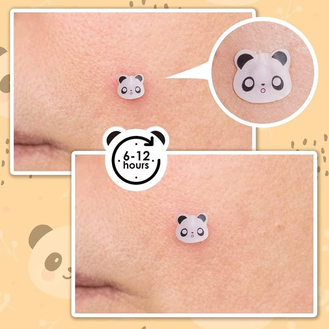 Parche de Acné Panda AUSLKA - 120 Puntos Hidrocoloides