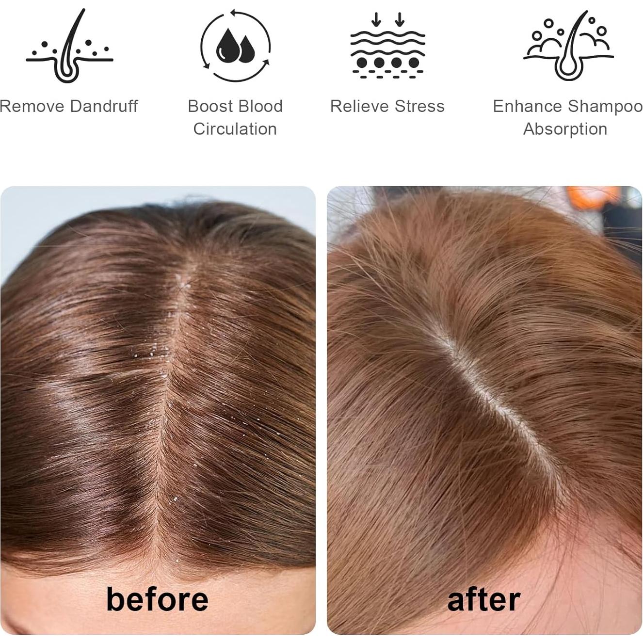 Masajeador de Cuero Cabelludo RHOS Azul, Cepillo de Champú Ergonómico