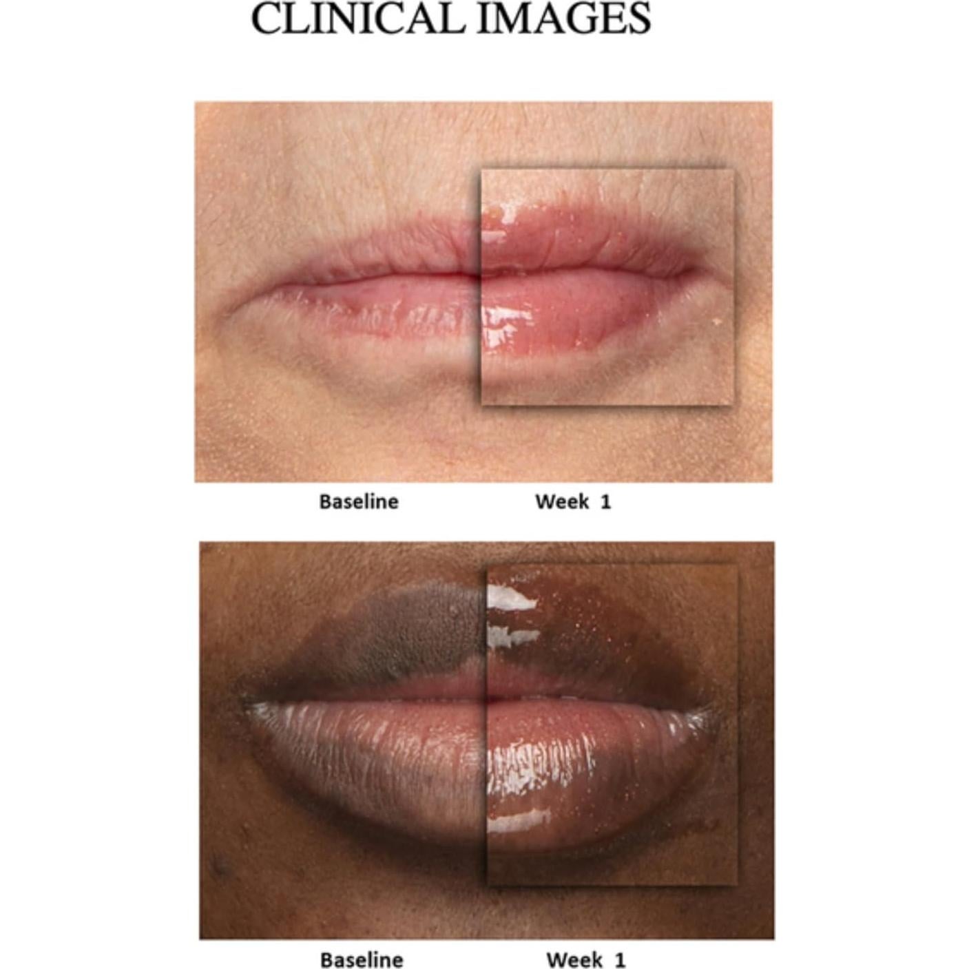 Aumentador de Labios Peptídico Nu Colour 7.93 ml - Hidratante y Voluminizador