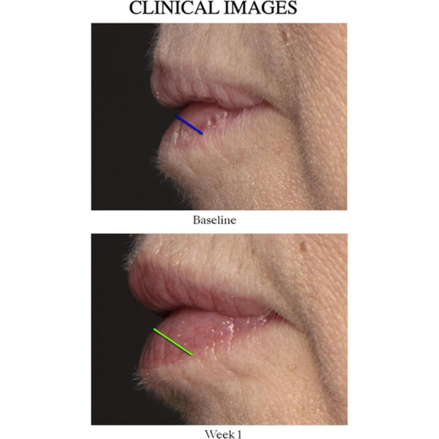 Aumentador de Labios Peptídico Nu Colour 7.93 ml - Hidratante y Voluminizador