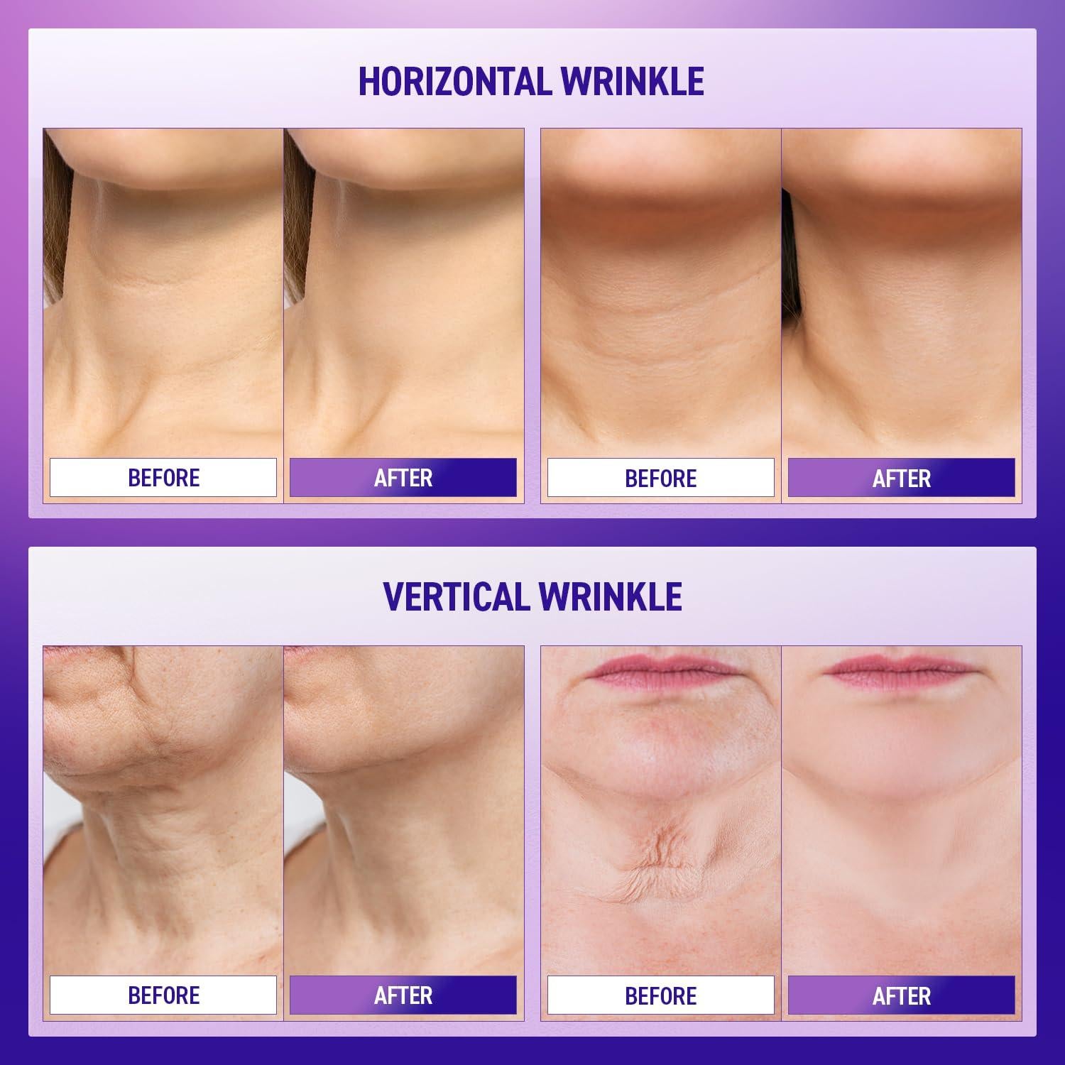 Crema reafirmante para cuello Ashania 50 ml con péptidos