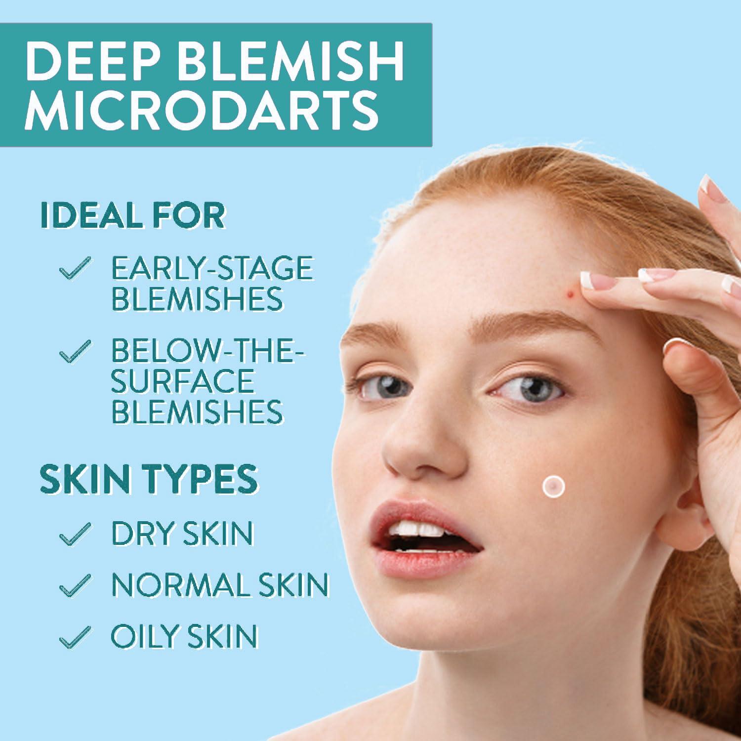 Parches de Acné Microdart VILVIN - 18 Parches Hidrocoloides