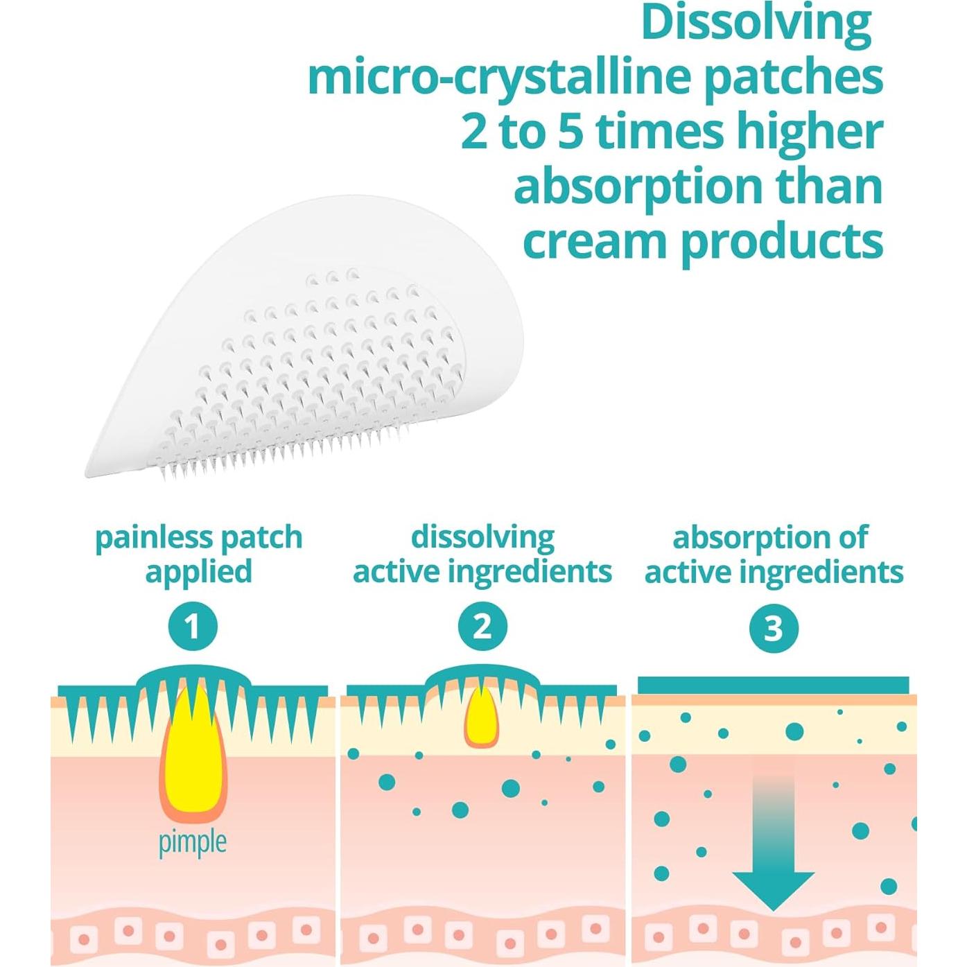 Parches de Acné Microdart VILVIN - 18 Parches Hidrocoloides