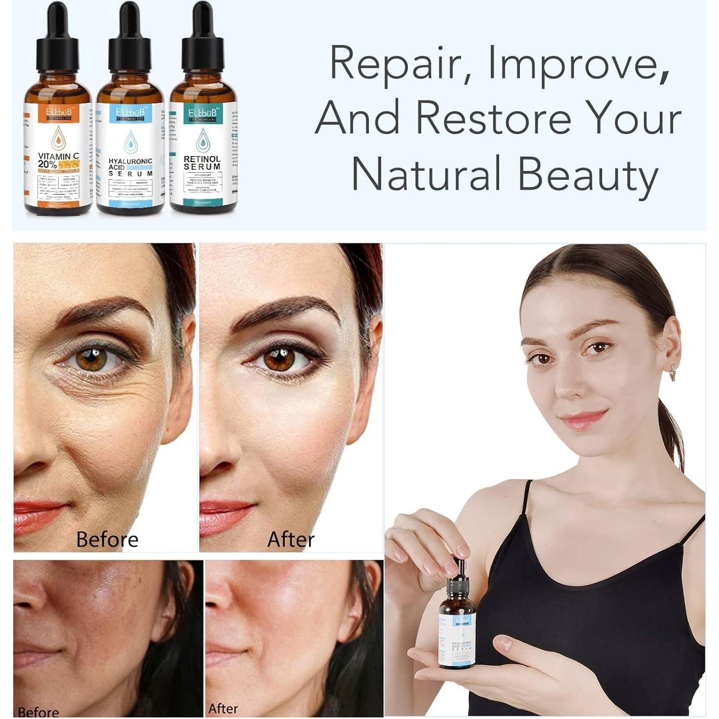 Set de Sueros Faciales ELBBUB - Vitamina C, Ácido Hialurónico y Retinol 30ml