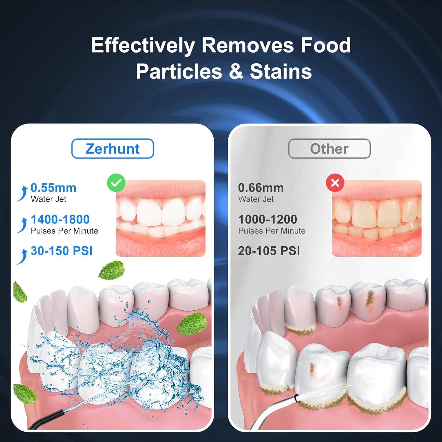 Irrigador Oral Portátil Zerhunt YXY-801 300ml 4 Modos IPX7