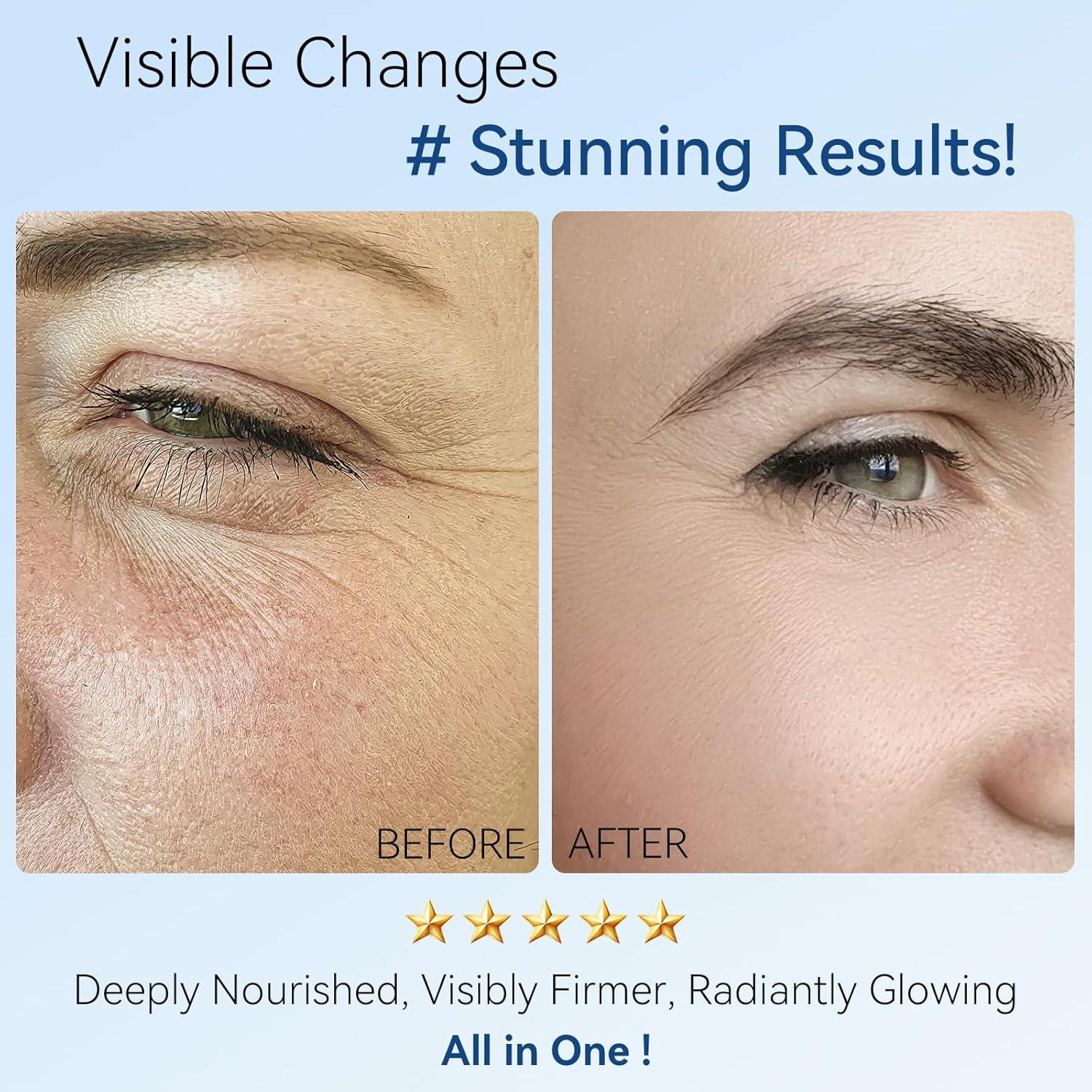 Crema Hidratante Antienvejecimiento UFEEK 39.9 ml con Retinol