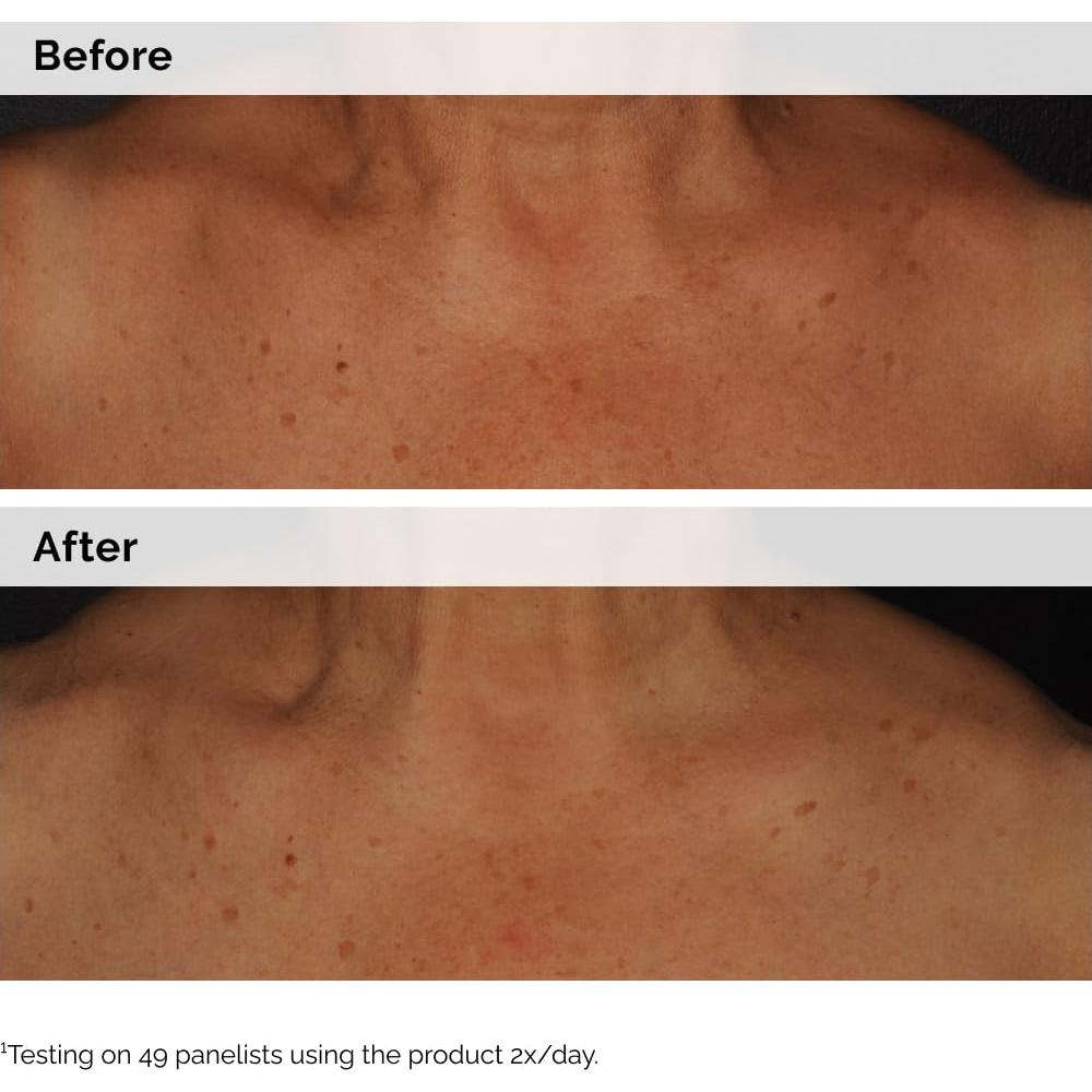 La Ordinaria Emulsión de Niacinamida 5% 100 ml - Corrector de Manchas