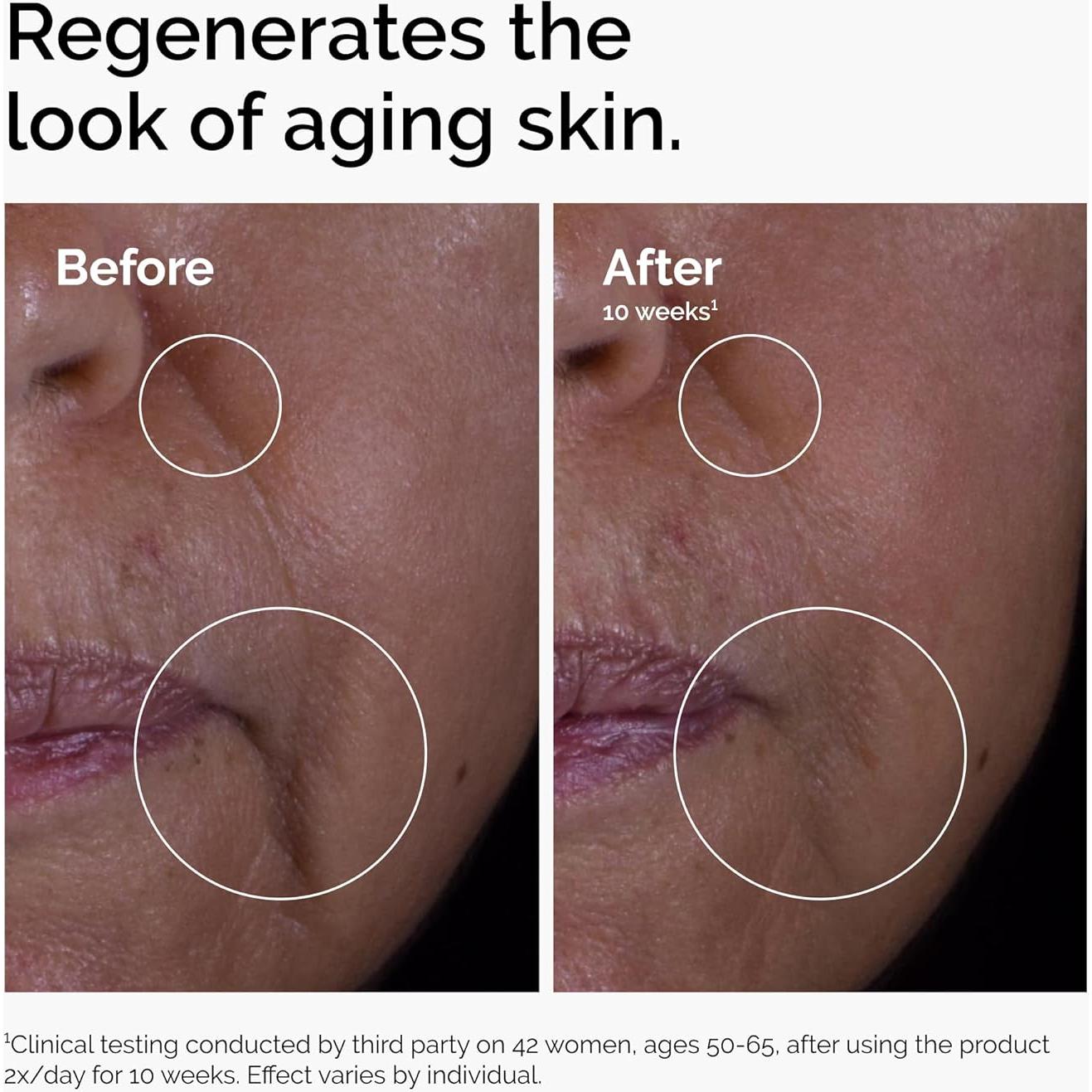 Suero Antienvejecimiento The Ordinary 15% 29.57 ml