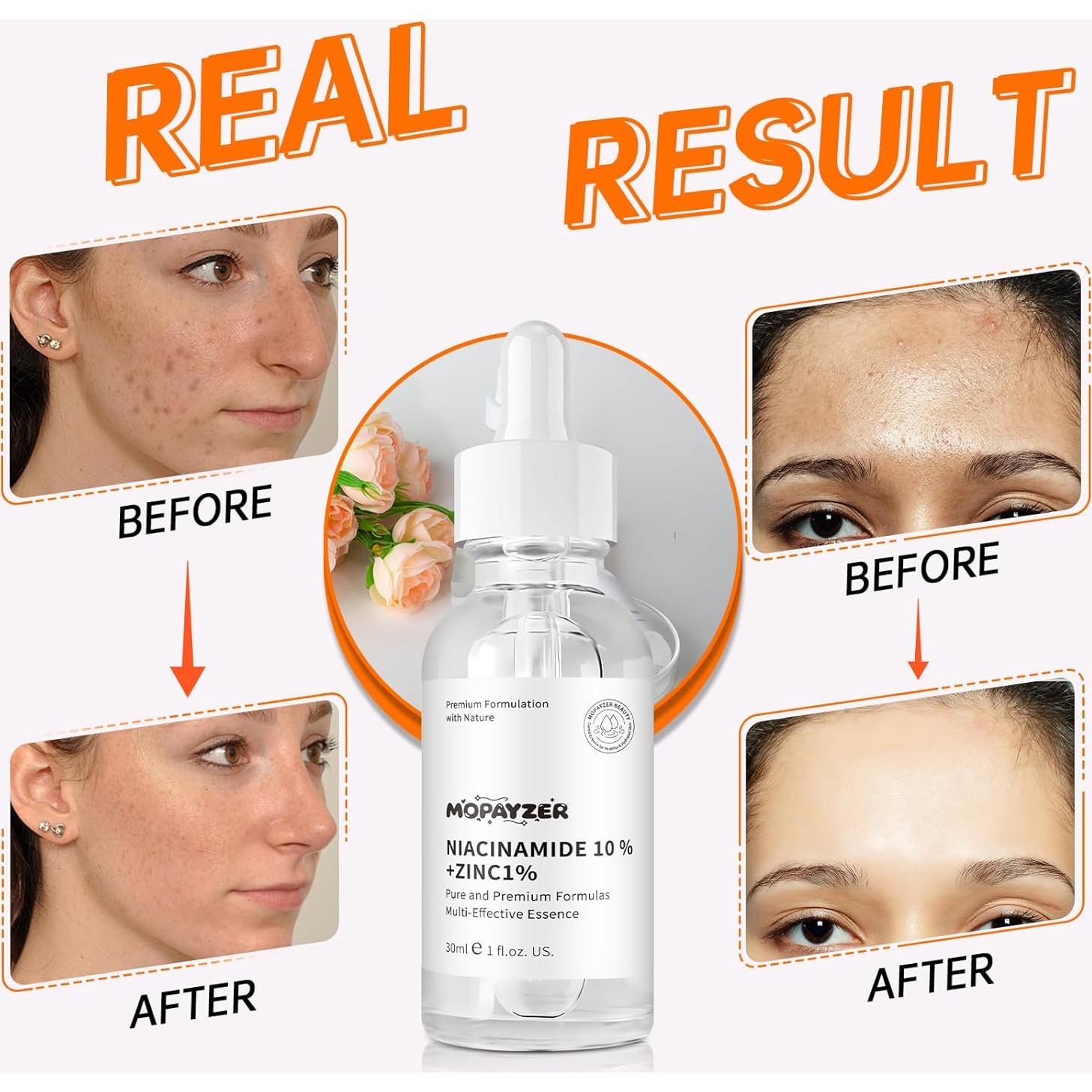 Suero Hidratante Facial Niacinamida 10% + Zinc 1% 82g