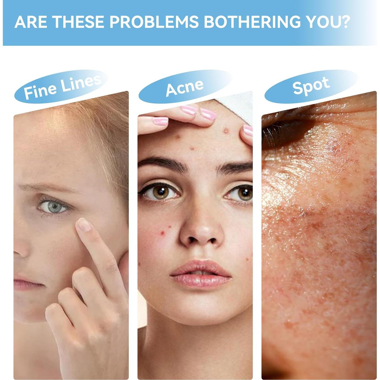 Suero Facial Niacinamida 10% + Zinc 1% 30ml - Control de Aceite y Acné