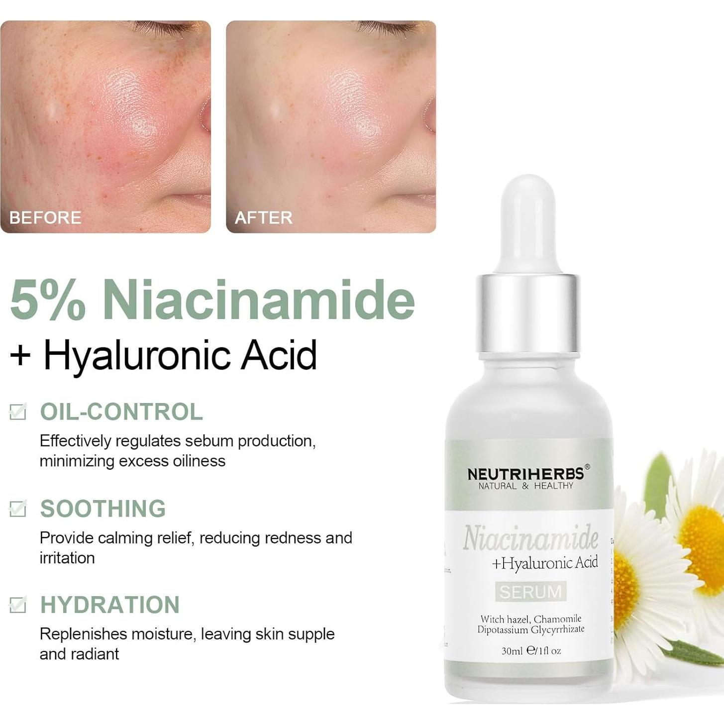 Suero de Niacinamida 5% The Ordinary - Control de Aceite Facial