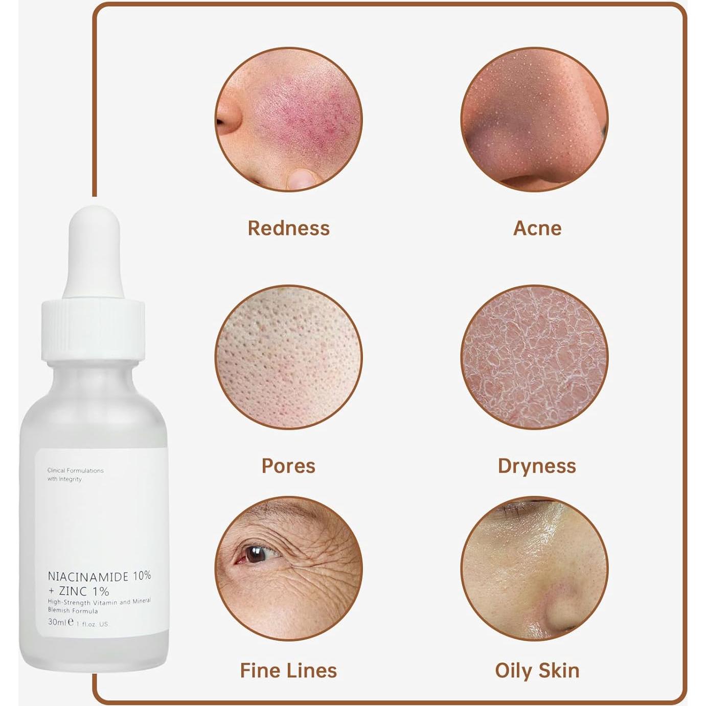 Suero Facial de Niacinamida 10% + Zinc 1% MIZEEYE 30ml