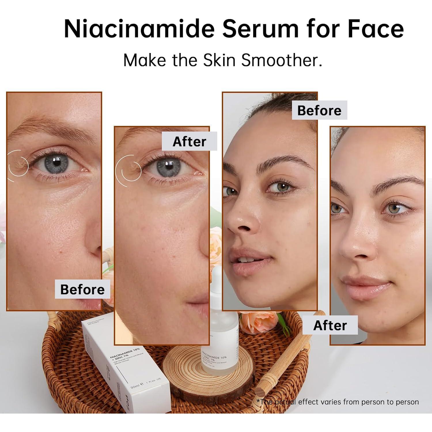 Suero Facial de Niacinamida 10% + Zinc 1% MIZEEYE 30ml