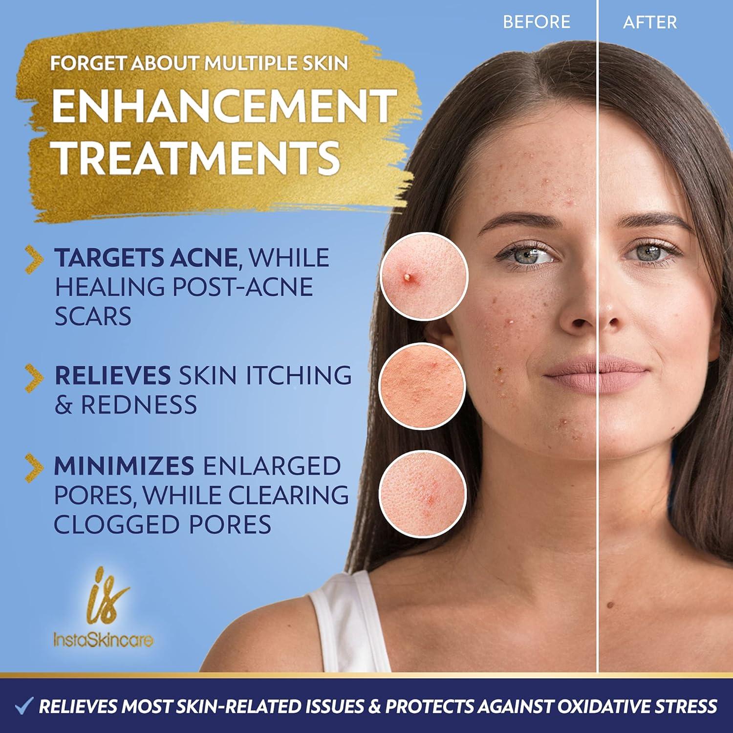 Suero de Niacinamida 10% con Zinc 1% InstaSkincare 60ml