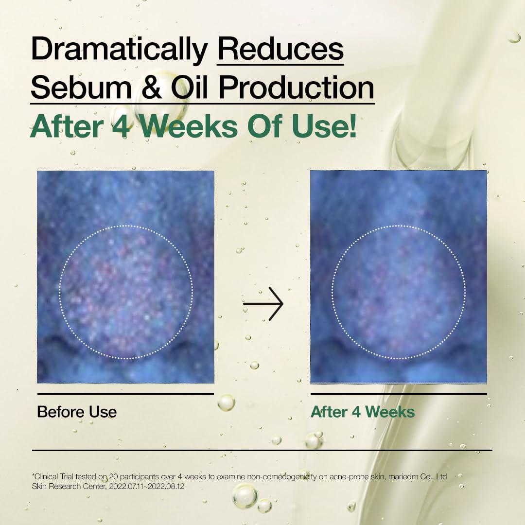 Set de Limpieza Facial Anua: Aceite, Espuma y Tónico Calmante