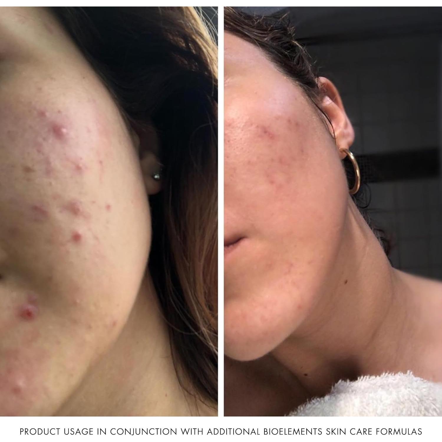 Limpiador Facial Hidratante Bioelements 177 ml - Vegano